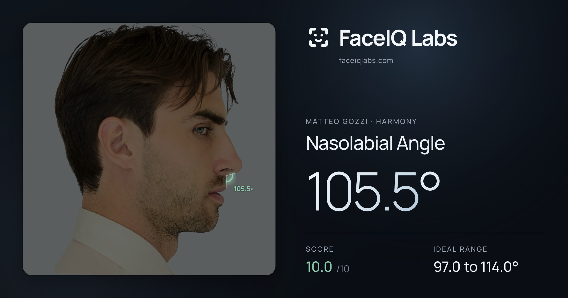 Matteo Gozzi Nasolabial Angle: 105.5°, drawn on the photo