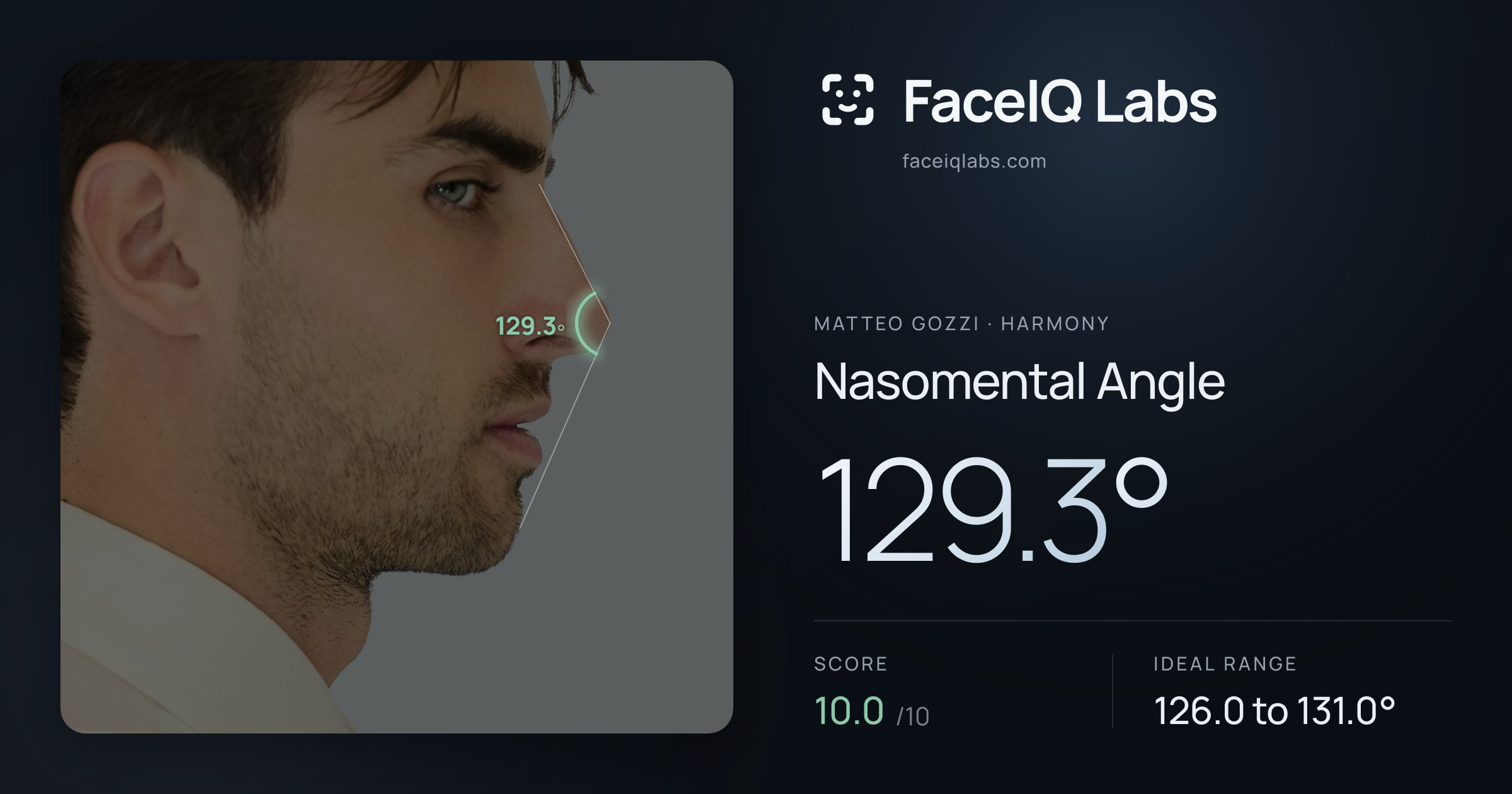 Matteo Gozzi Nasomental Angle: 129.3°, drawn on the photo