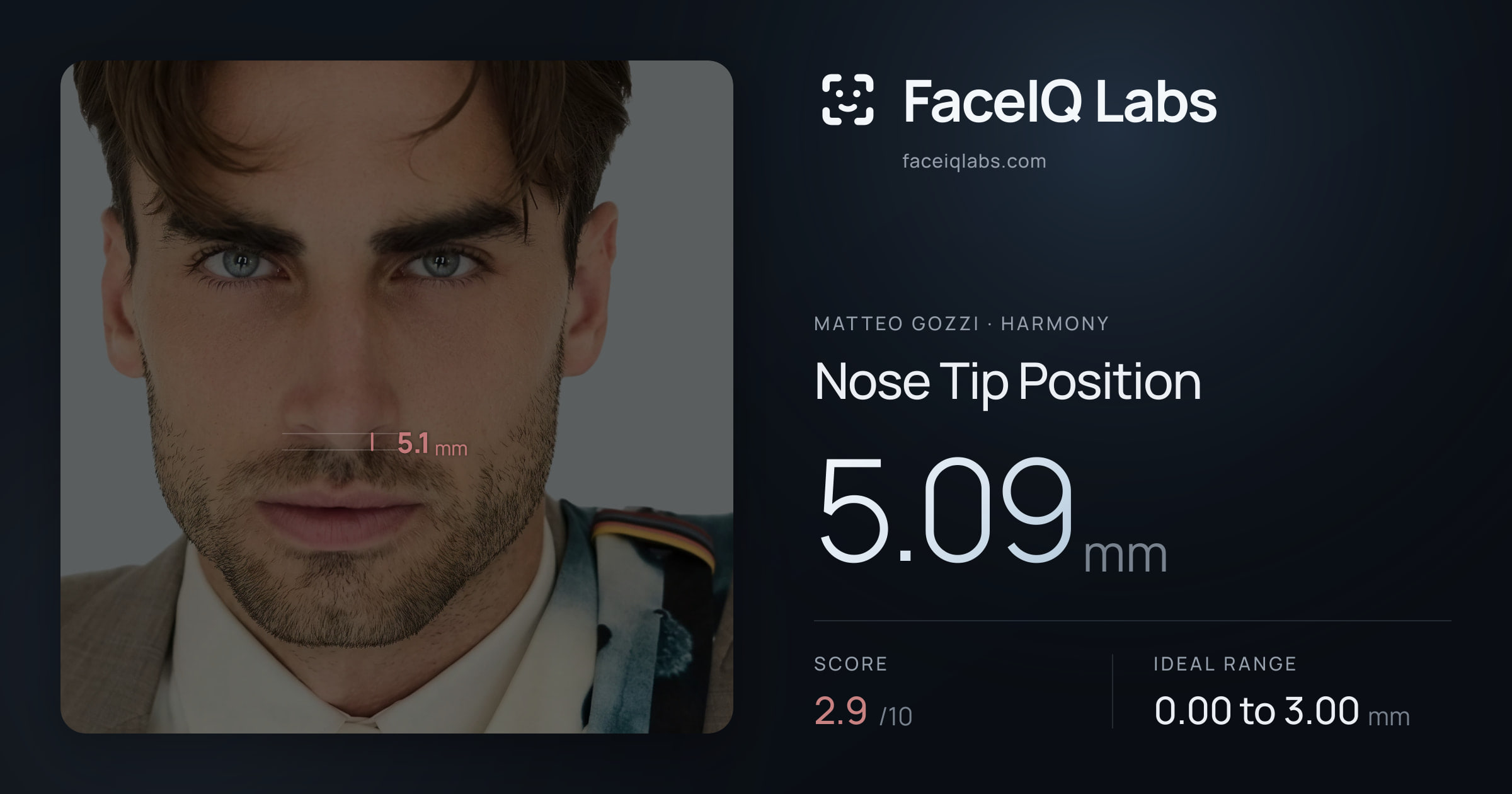 Matteo Gozzi Nose Tip Position: 5.09mm, drawn on the photo