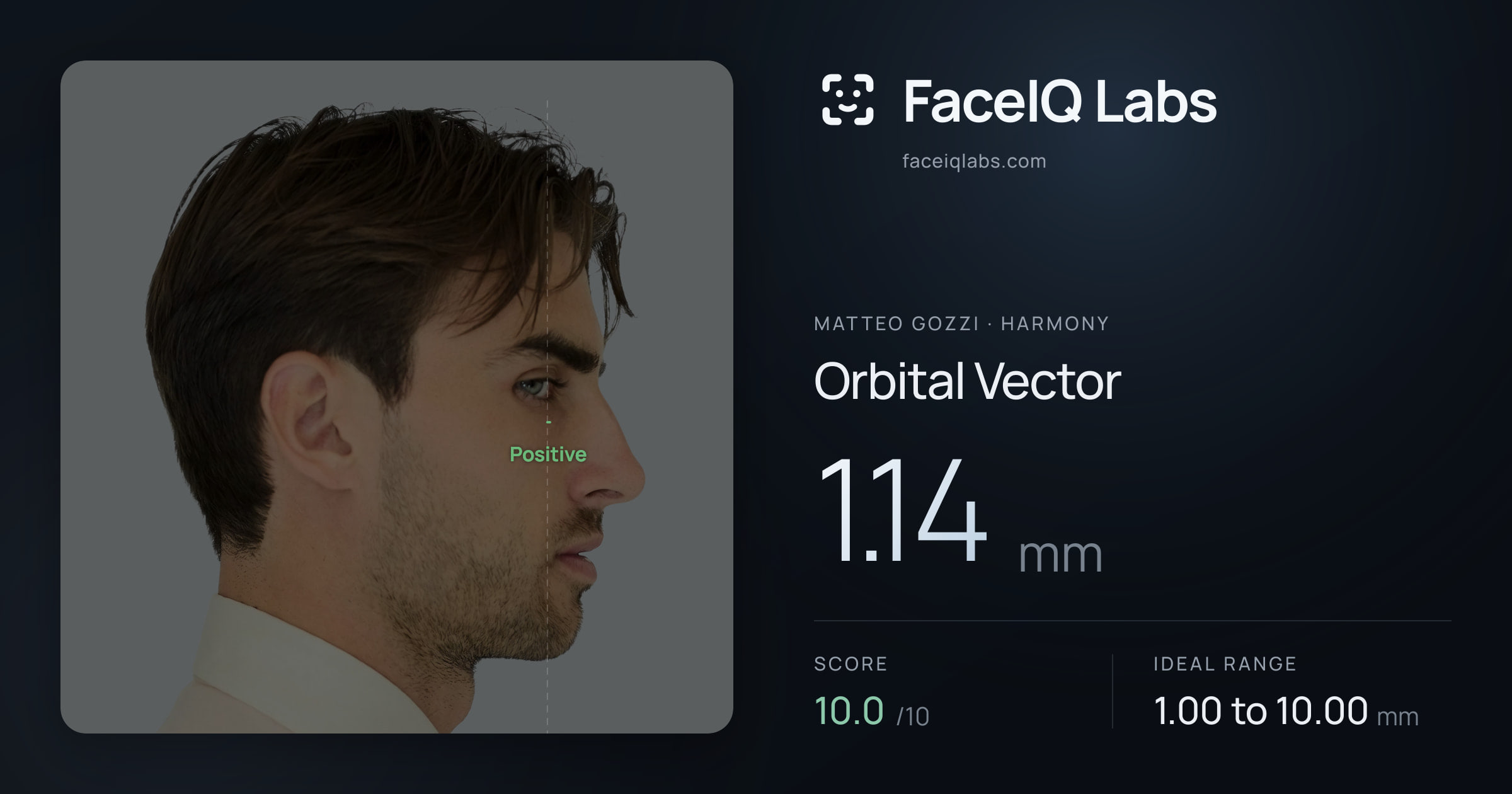 Matteo Gozzi Orbital Vector: 1.14mm, drawn on the photo