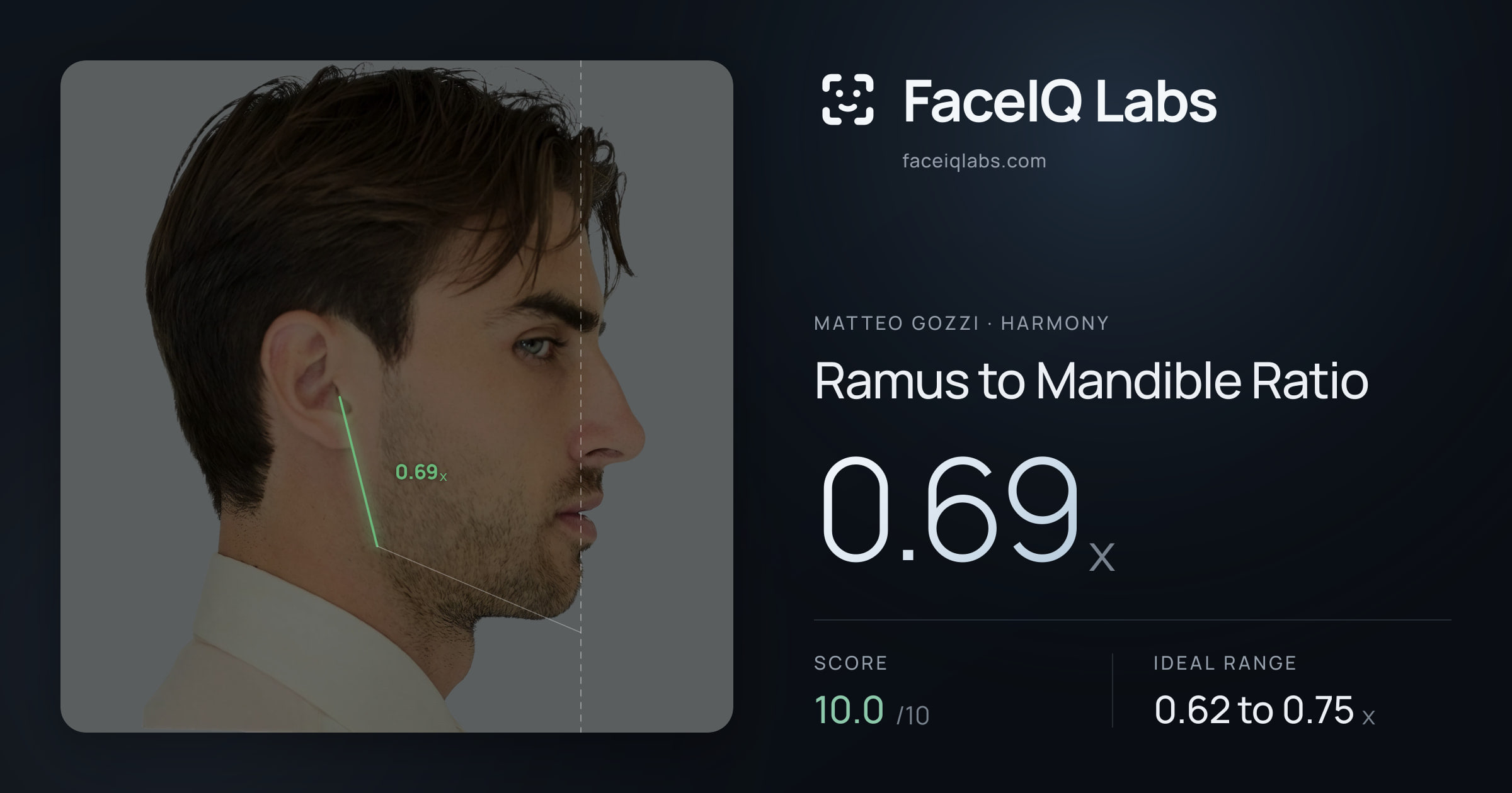 Matteo Gozzi Ramus to Mandible Ratio: 0.69x, drawn on the photo