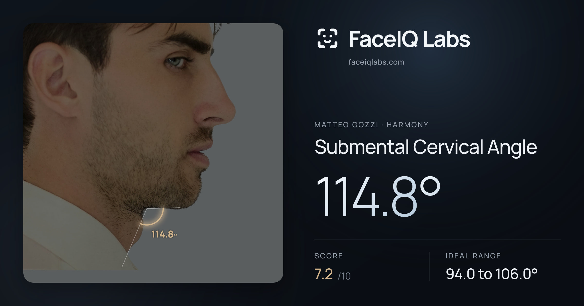 Matteo Gozzi Submental Cervical Angle: 114.8°, drawn on the photo