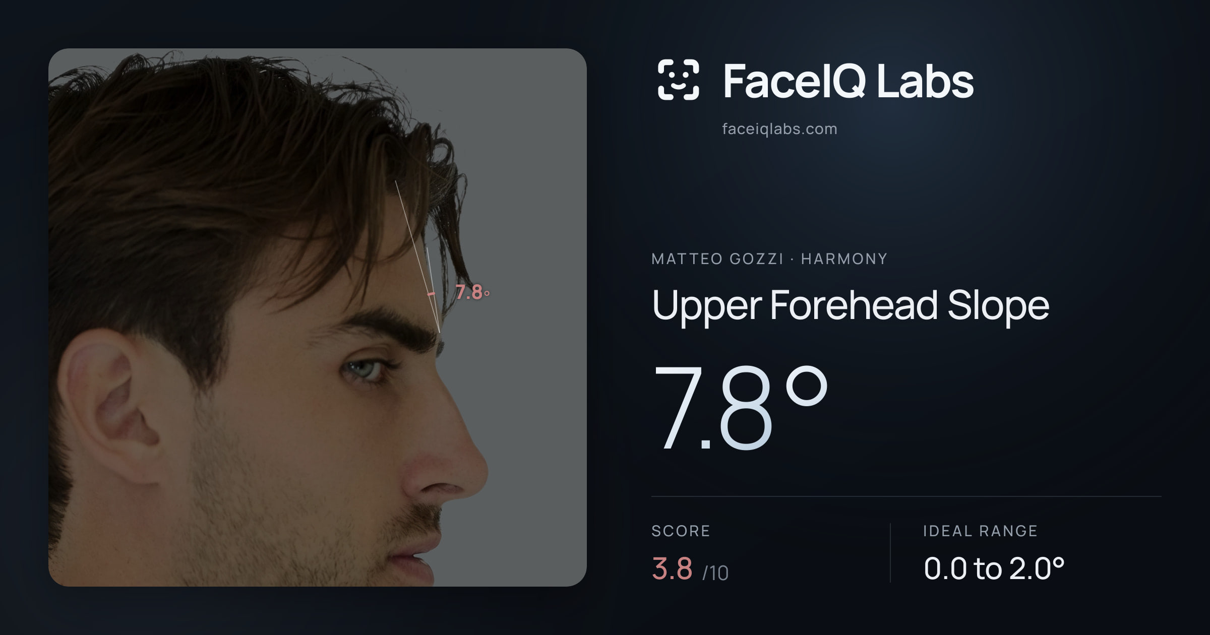 Matteo Gozzi Upper Forehead Slope: 7.8°, drawn on the photo