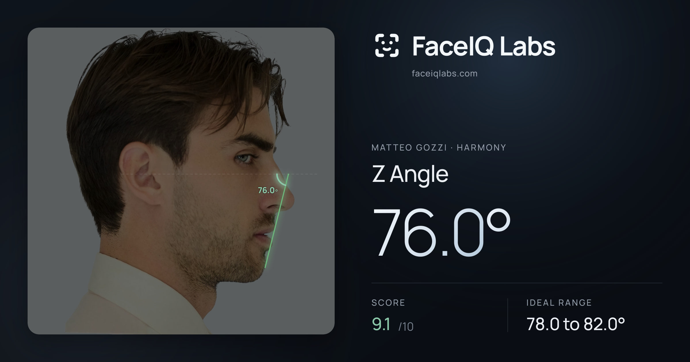 Matteo Gozzi Z Angle: 76.0°, drawn on the photo