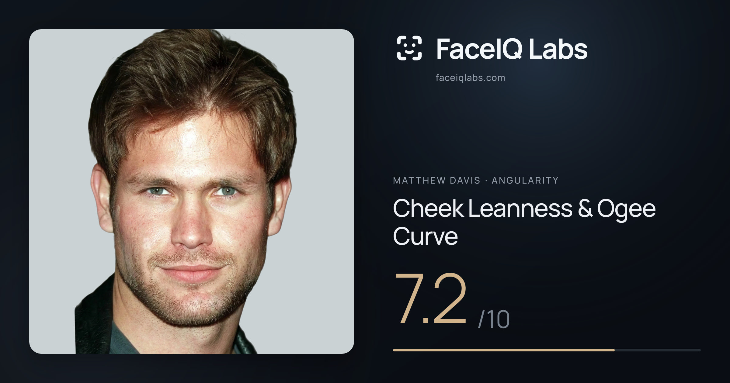 Matthew Davis Cheek Leanness & Ogee Curve: 7.2/10, drawn on the photo
