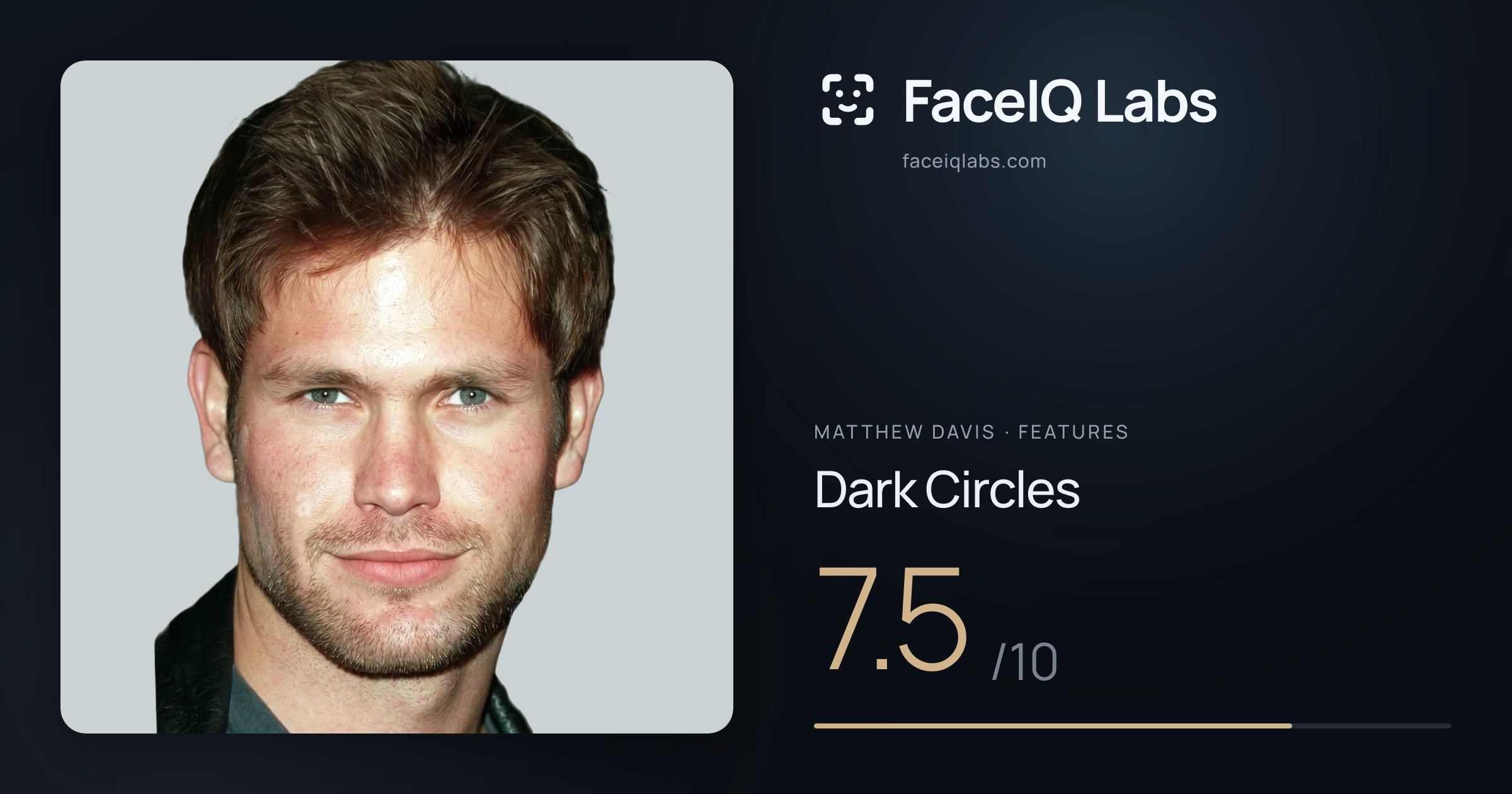 Matthew Davis Dark Circles: 7.5/10, drawn on the photo