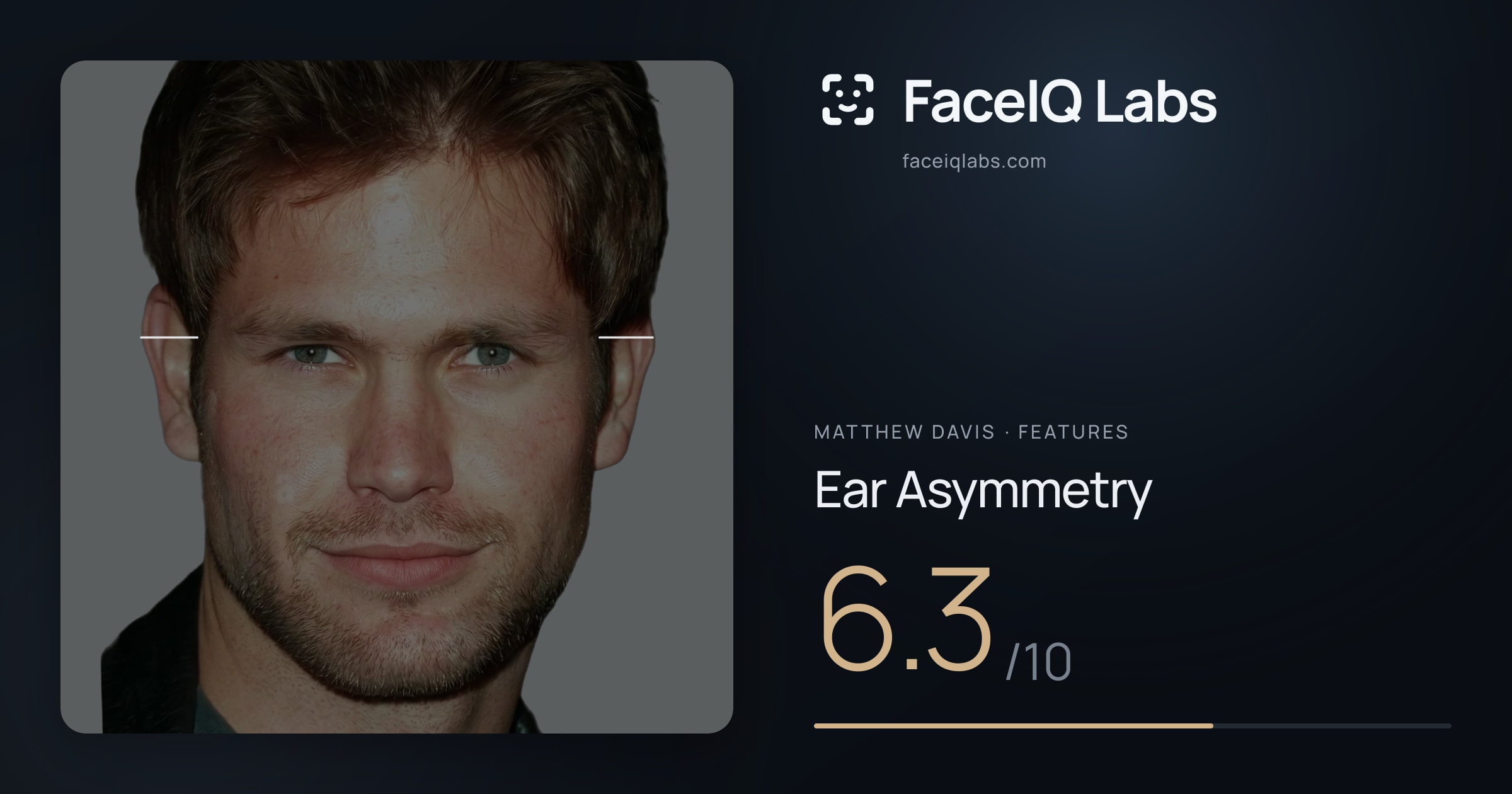 Matthew Davis Ear Asymmetry: 6.3/10, drawn on the photo