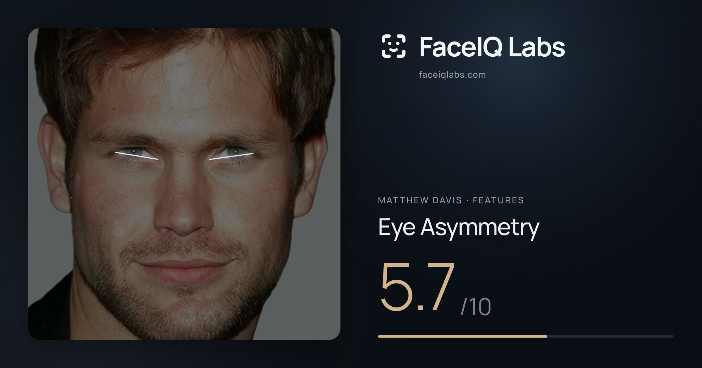 Matthew Davis Eye Asymmetry: 5.7/10, drawn on the photo