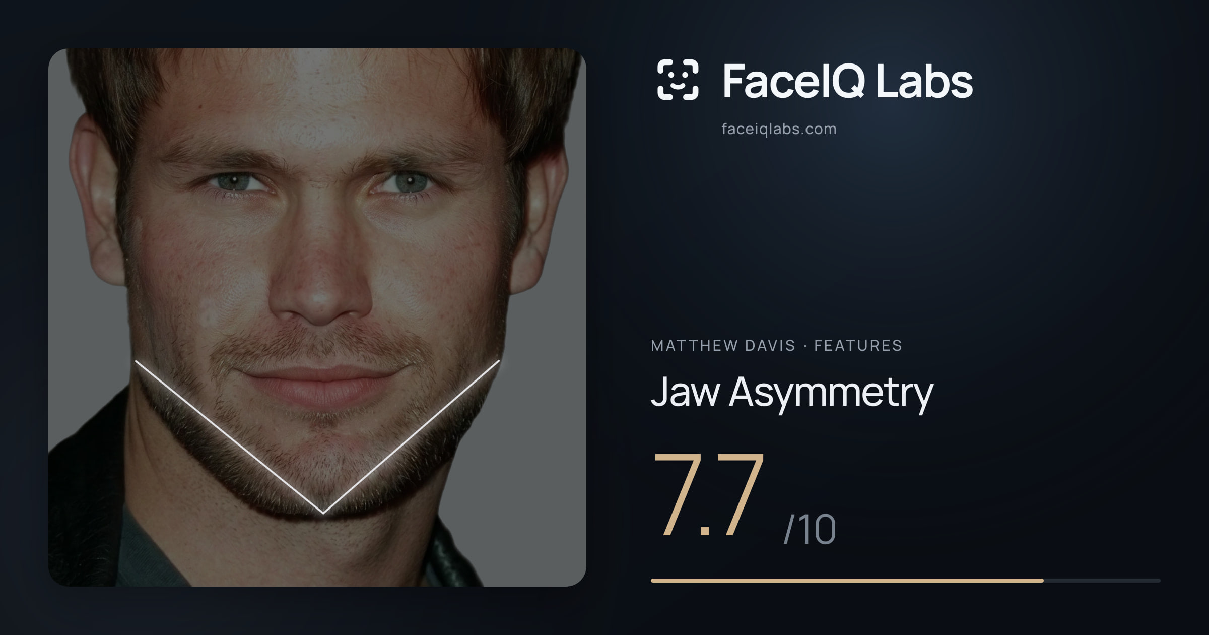 Matthew Davis Jaw Asymmetry: 7.7/10, drawn on the photo