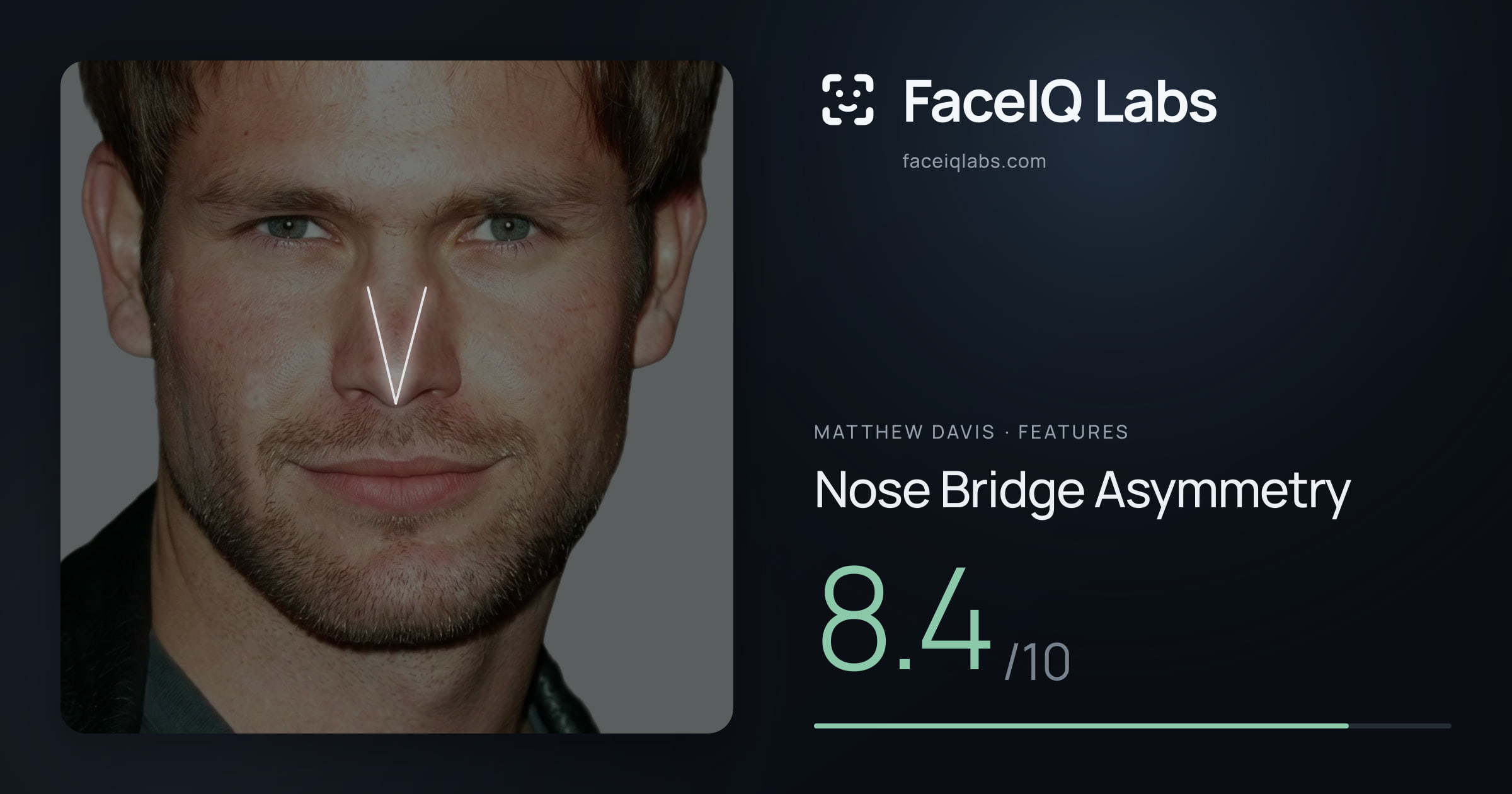 Matthew Davis Nose Bridge Asymmetry: 8.4/10, drawn on the photo