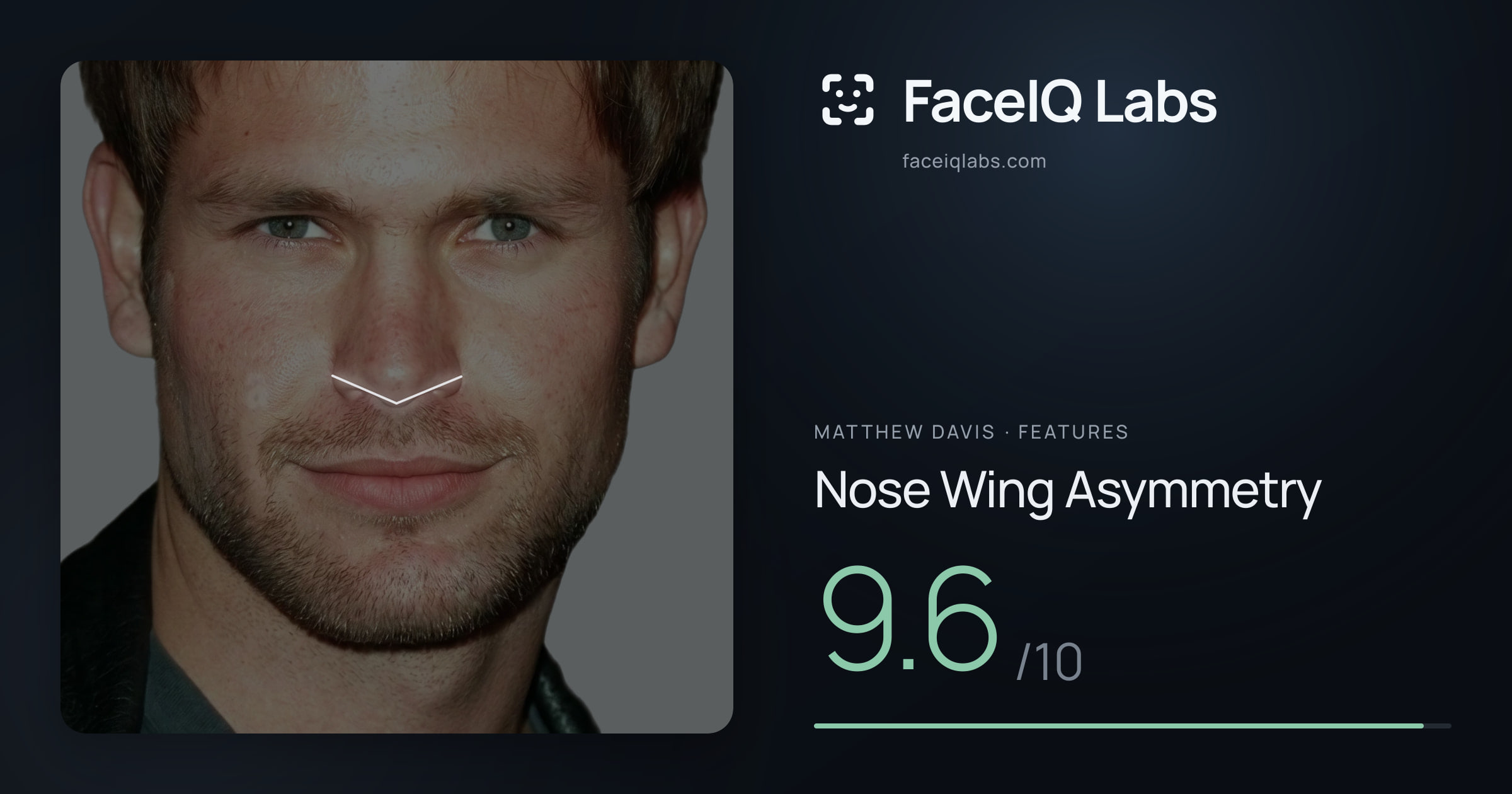 Matthew Davis Nose Wing Asymmetry: 9.6/10, drawn on the photo