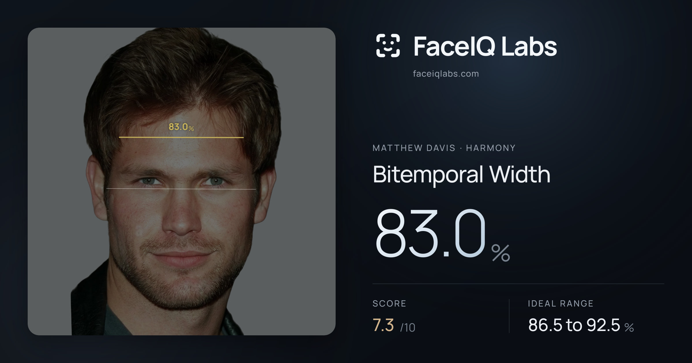 Matthew Davis Bitemporal Width: 83.0%, drawn on the photo