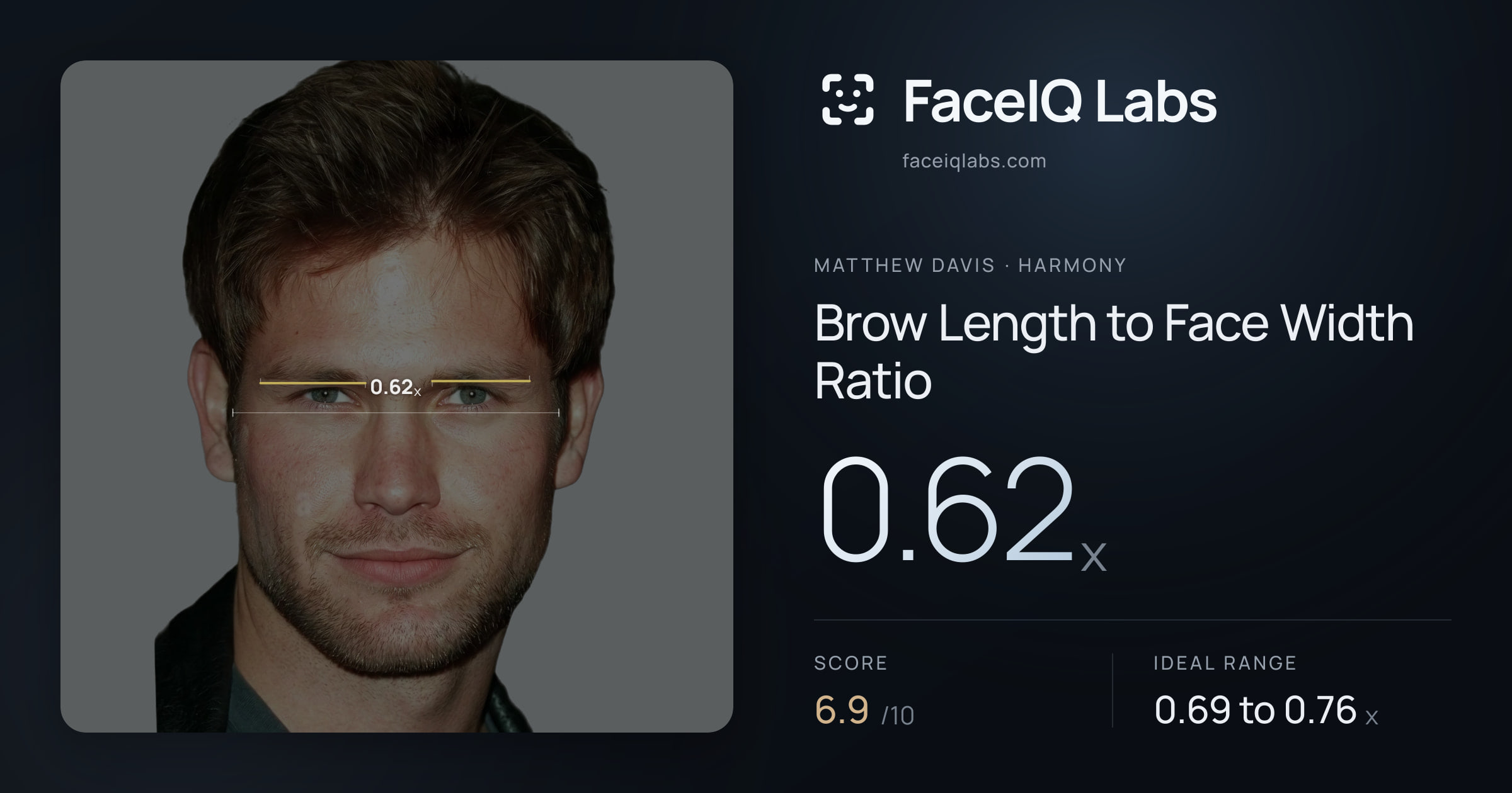 Matthew Davis Brow Length to Face Width Ratio: 0.62x, drawn on the photo
