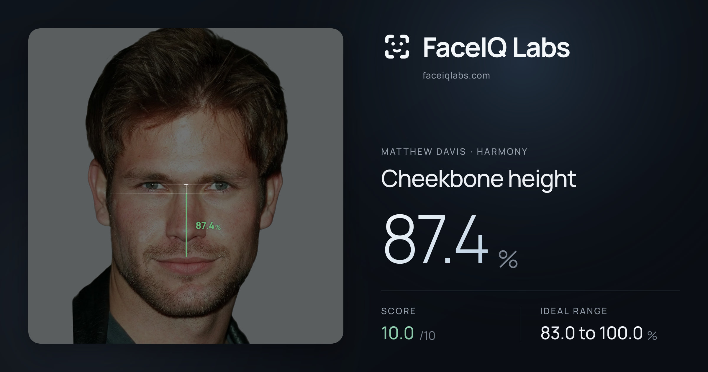 Matthew Davis Cheekbone height: 87.4%, drawn on the photo