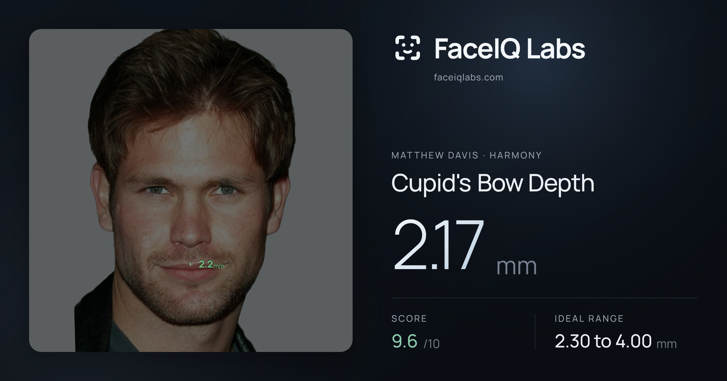 Matthew Davis Cupid's Bow Depth: 2.17mm, drawn on the photo