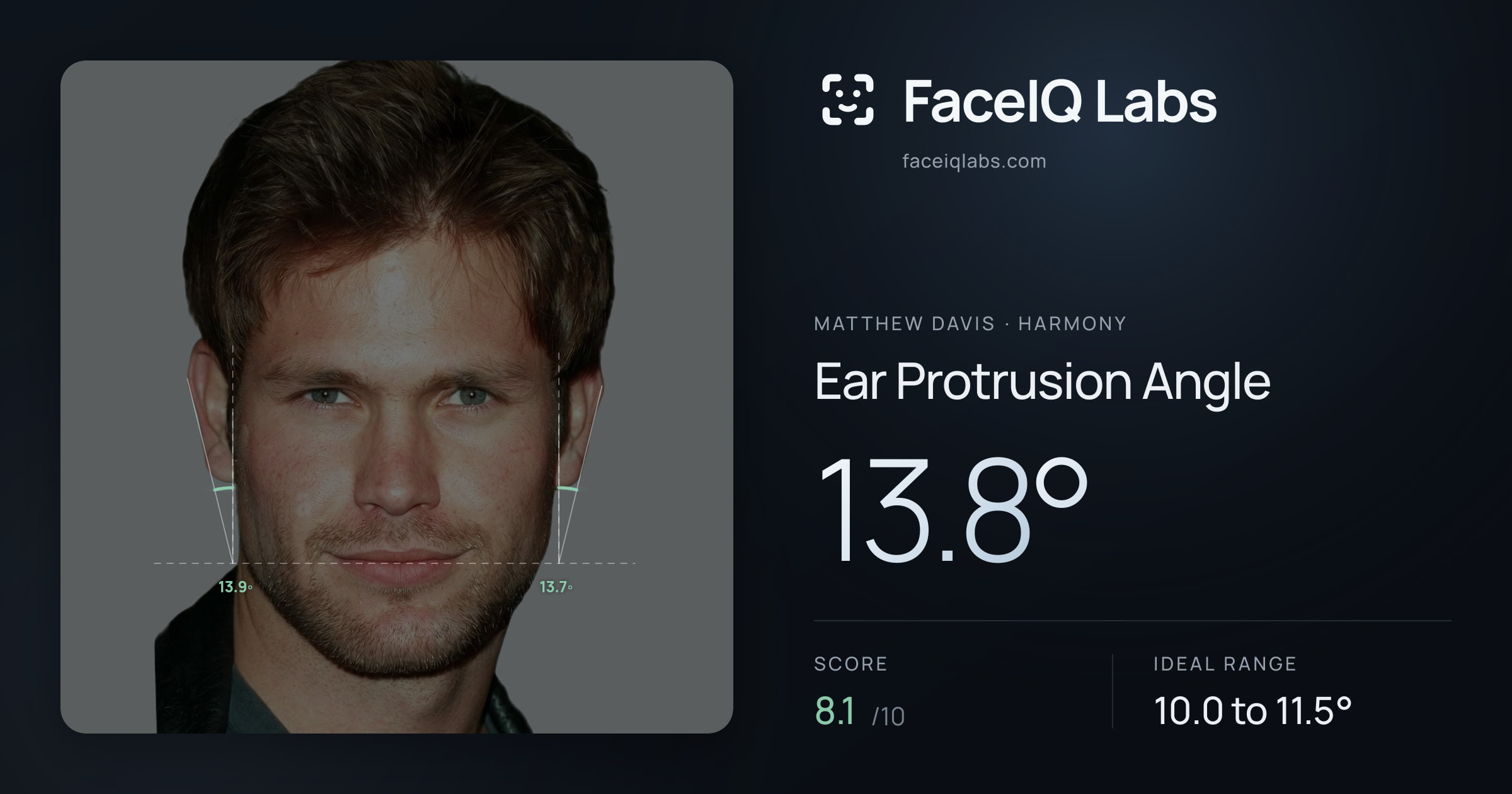 Matthew Davis Ear Protrusion Angle: 13.8°, drawn on the photo