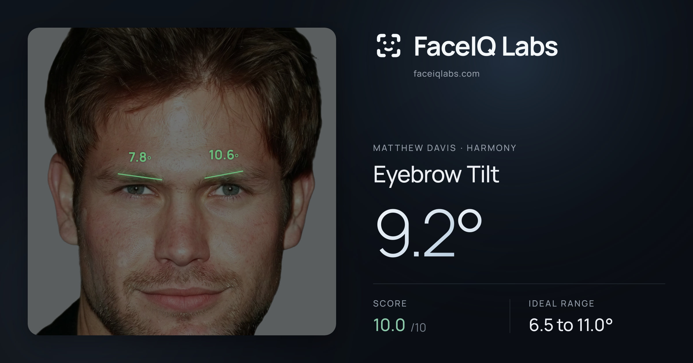 Matthew Davis Eyebrow Tilt: 9.2°, drawn on the photo