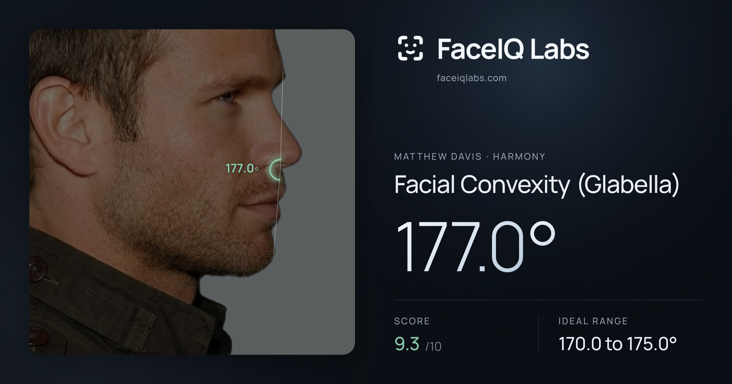 Matthew Davis Facial Convexity (Glabella): 177.0°, drawn on the photo