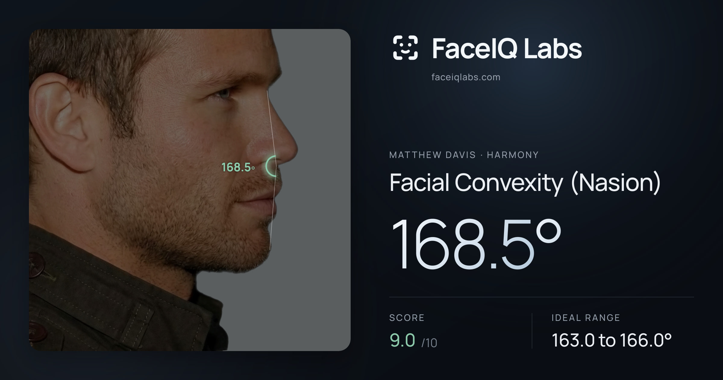 Matthew Davis Facial Convexity (Nasion): 168.5°, drawn on the photo