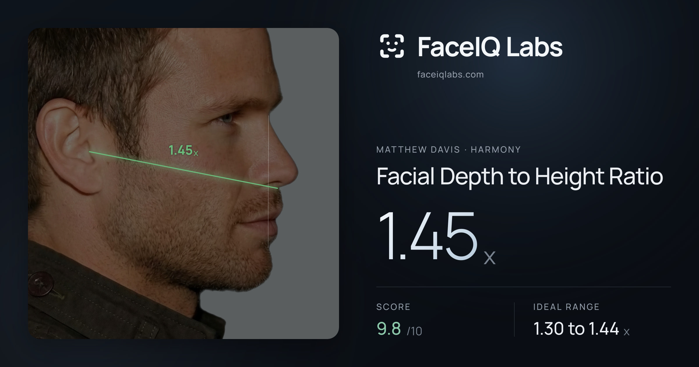 Matthew Davis Facial Depth to Height Ratio: 1.45x, drawn on the photo