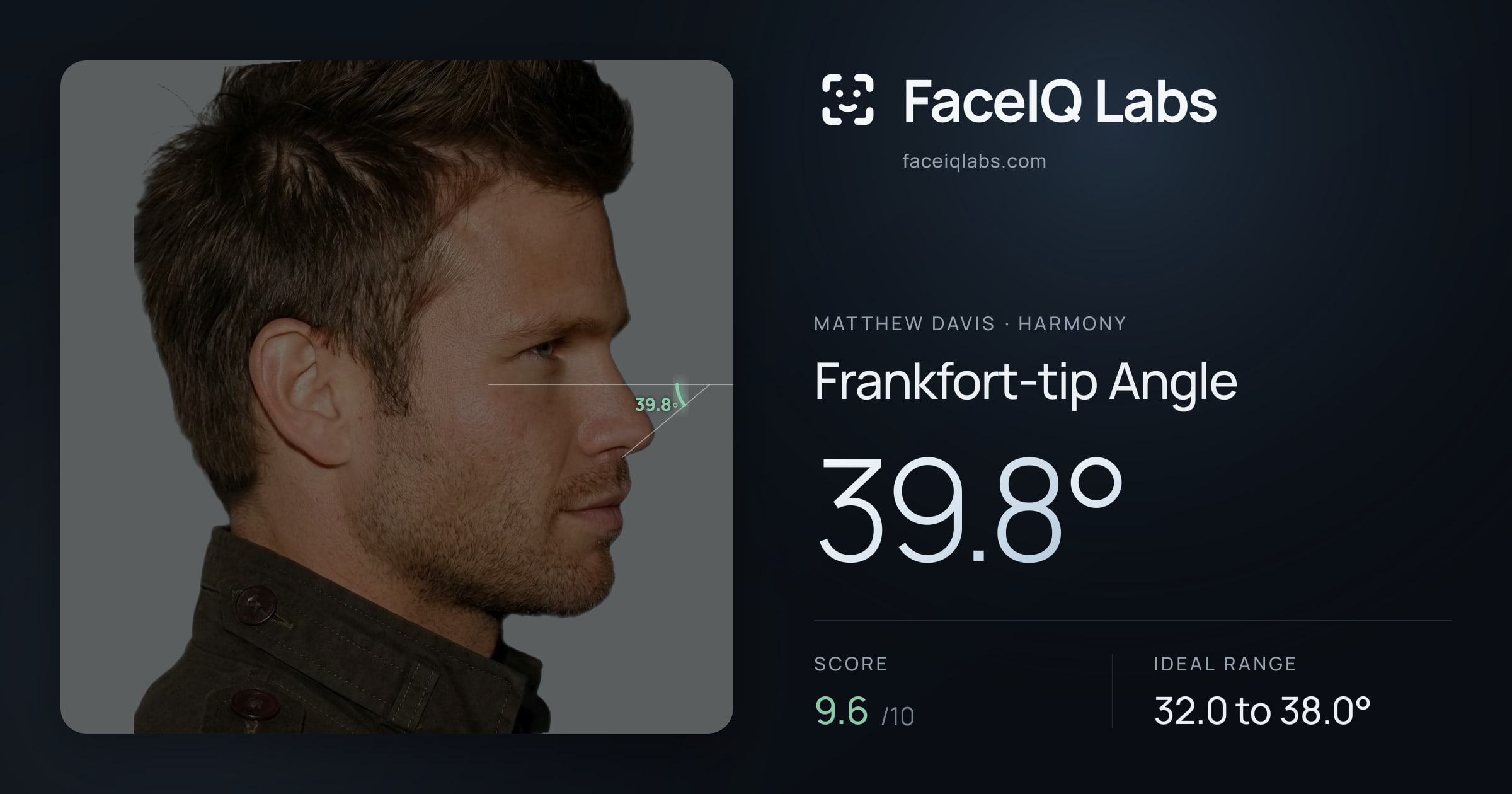 Matthew Davis Frankfort-tip Angle: 39.8°, drawn on the photo