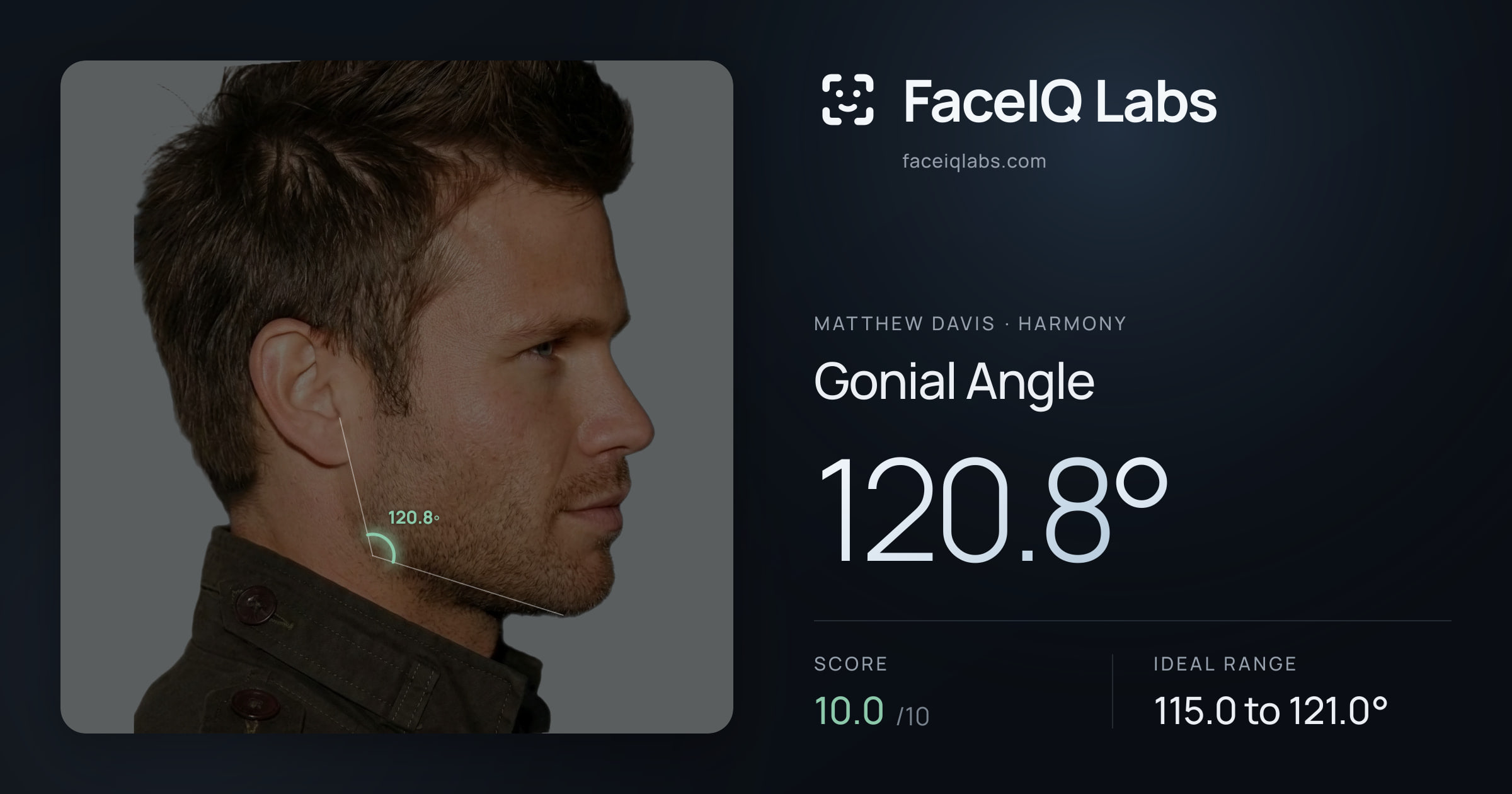 Matthew Davis Gonial Angle: 120.8°, drawn on the photo