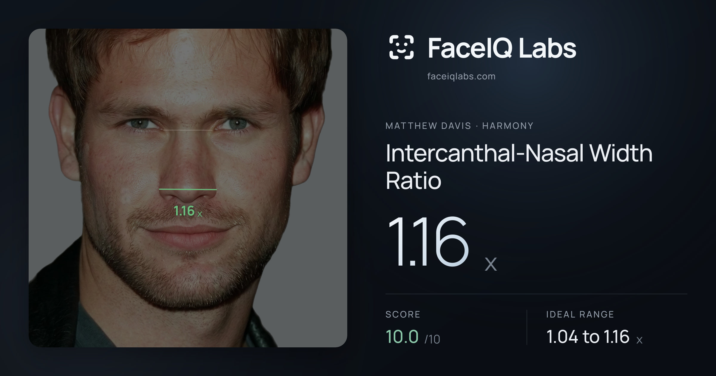 Matthew Davis Intercanthal-Nasal Width Ratio: 1.16x, drawn on the photo