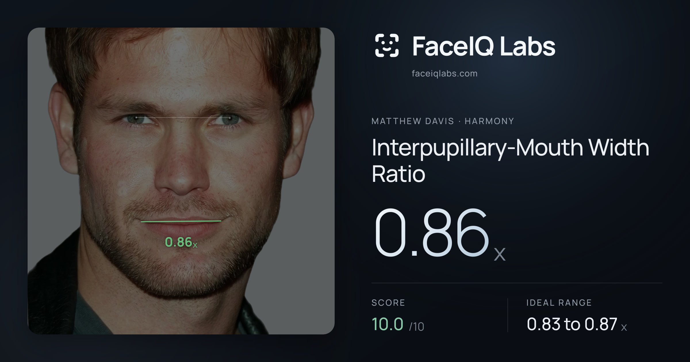 Matthew Davis Interpupillary-Mouth Width Ratio: 0.86x, drawn on the photo