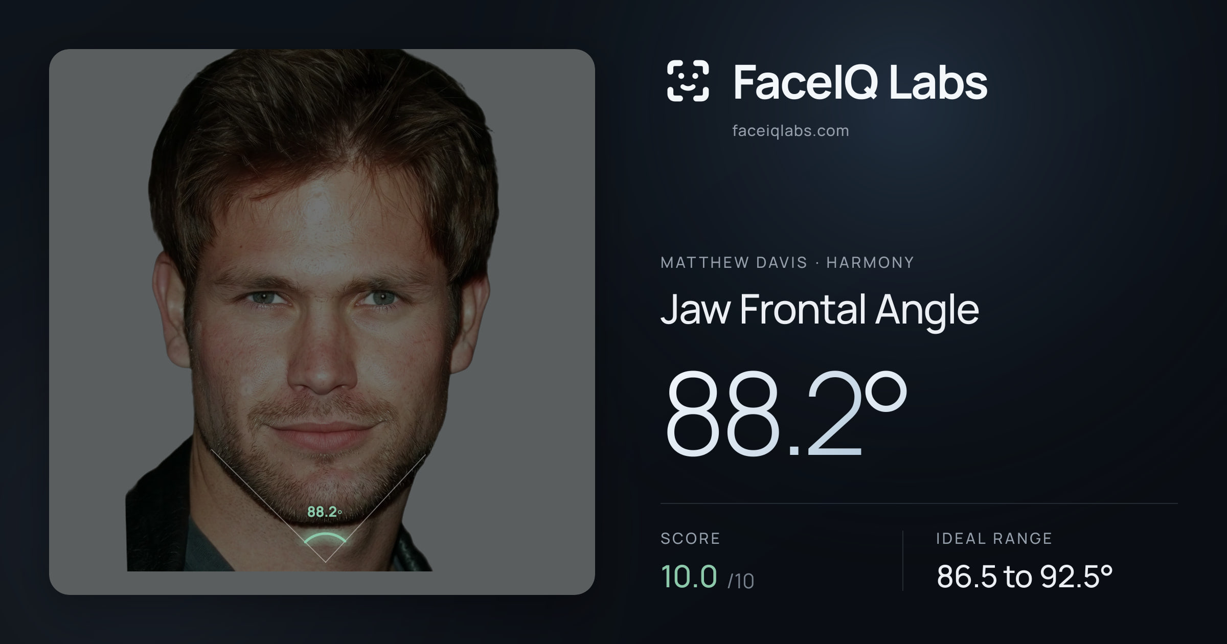 Matthew Davis Jaw Frontal Angle: 88.2°, drawn on the photo