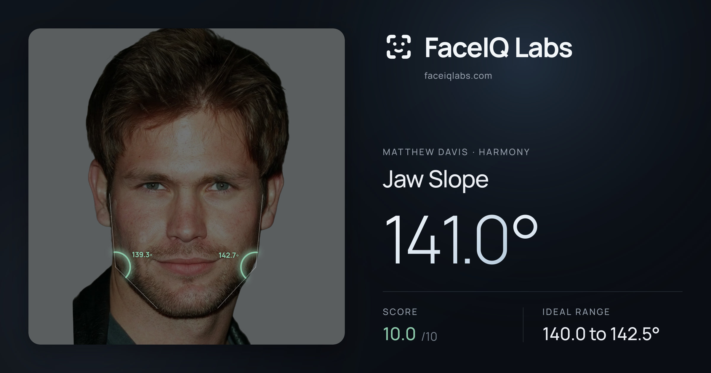 Matthew Davis Jaw Slope: 141.0°, drawn on the photo
