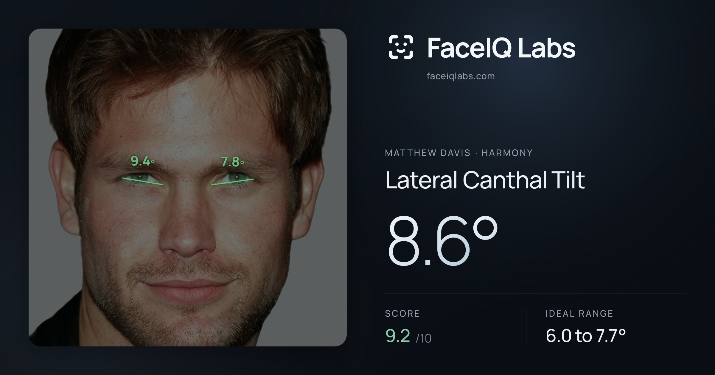 Matthew Davis Lateral Canthal Tilt: 8.6°, drawn on the photo
