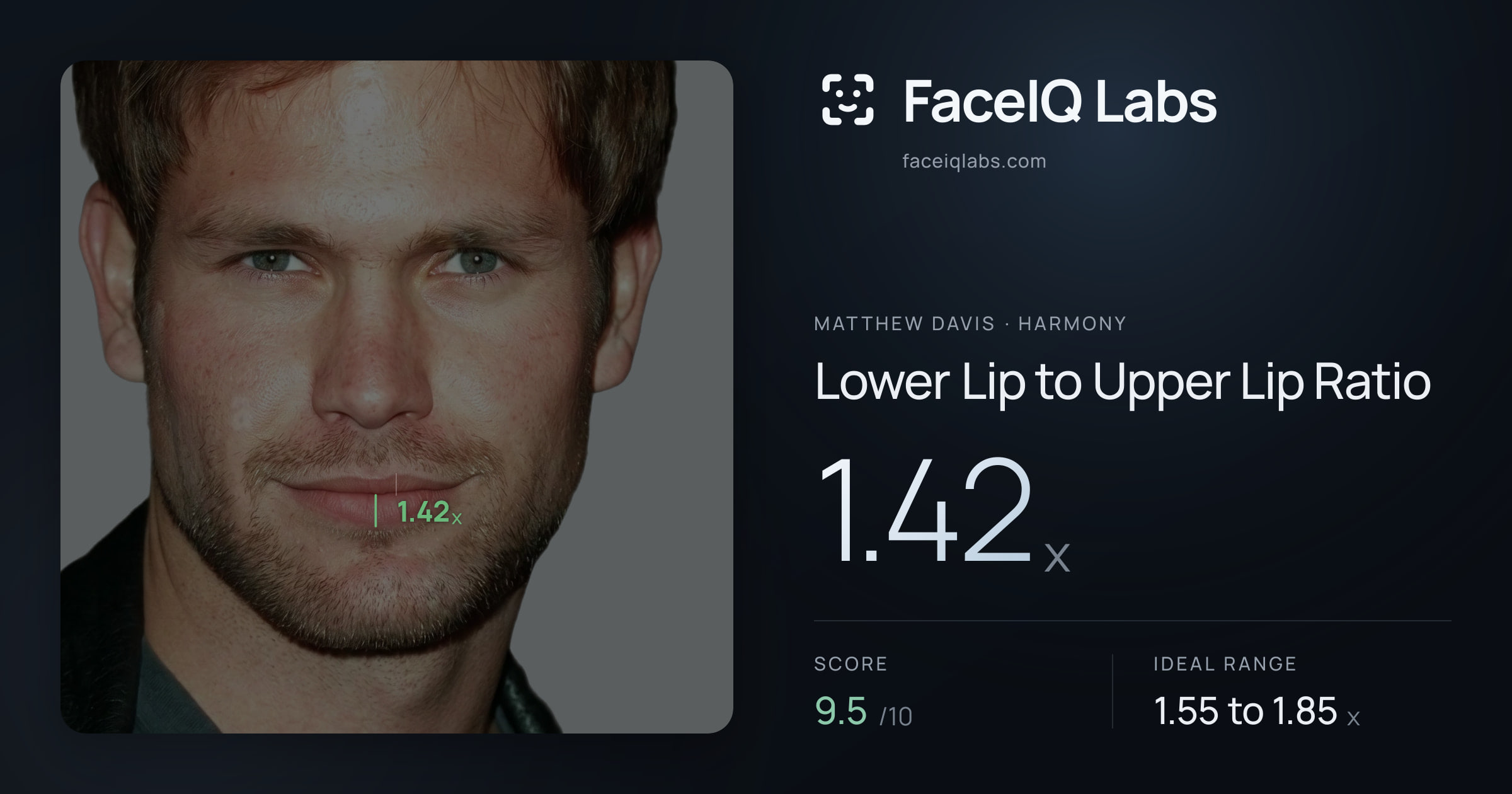 Matthew Davis Lower Lip to Upper Lip Ratio: 1.42x, drawn on the photo