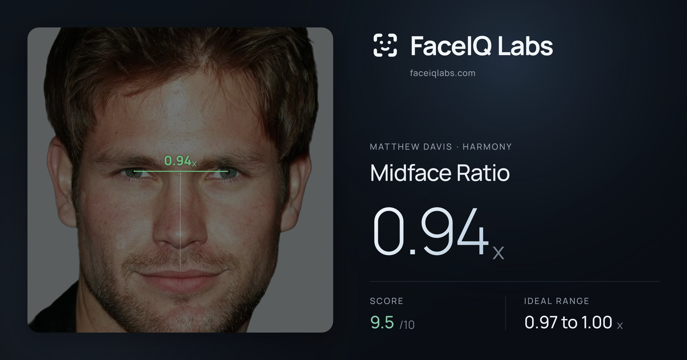 Matthew Davis Midface Ratio: 0.94x, drawn on the photo