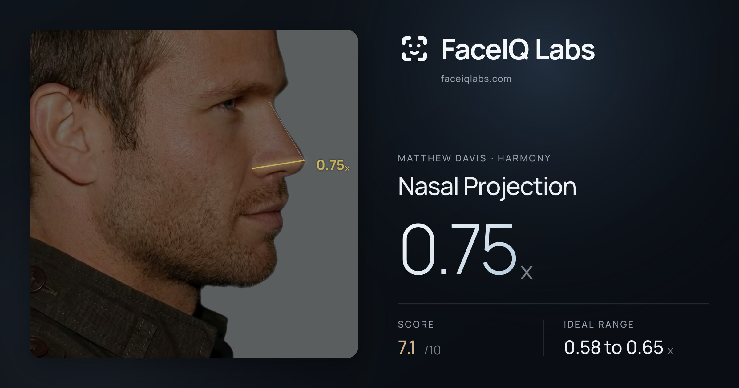 Matthew Davis Nasal Projection: 0.75x, drawn on the photo