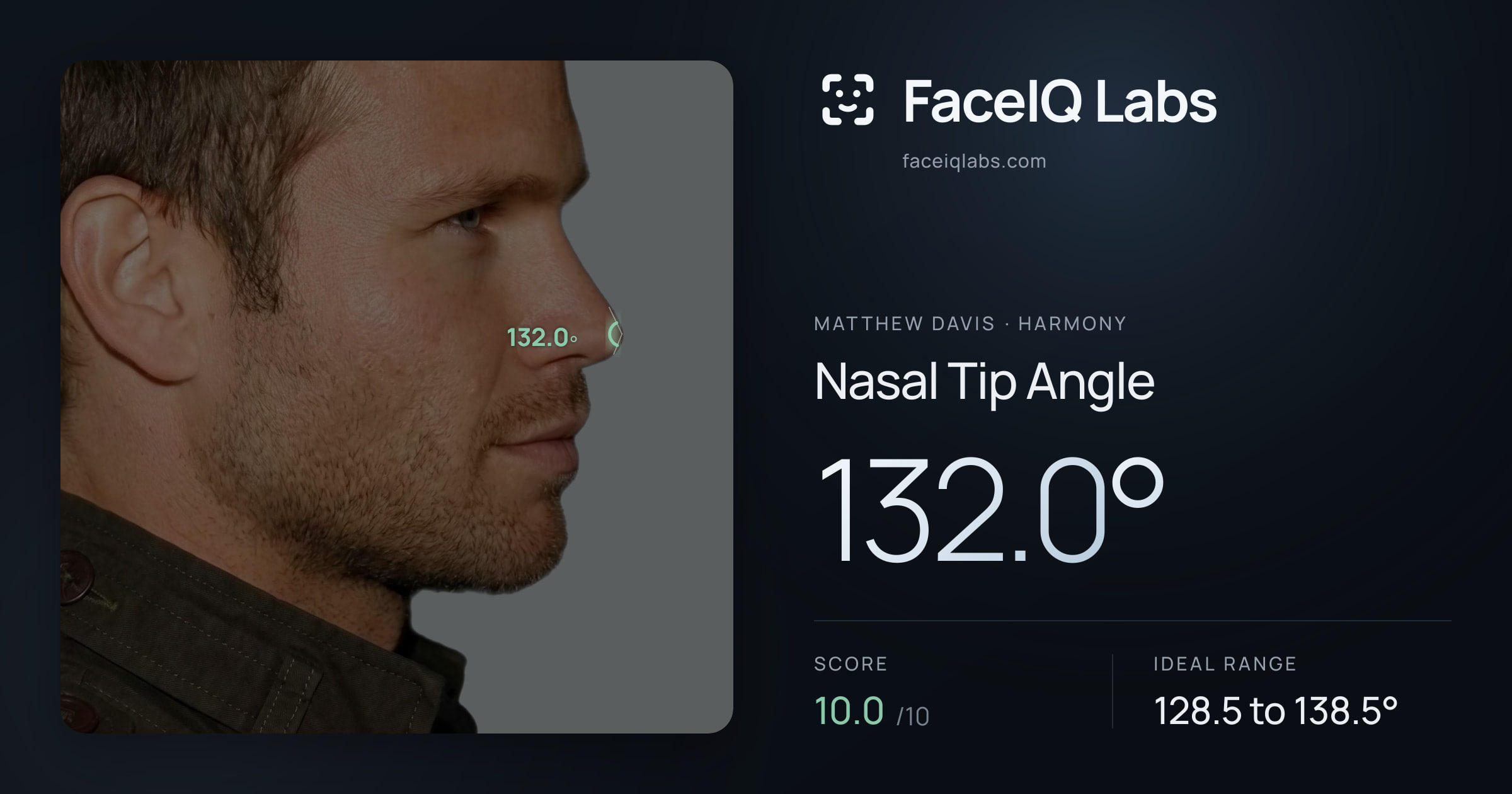 Matthew Davis Nasal Tip Angle: 132.0°, drawn on the photo