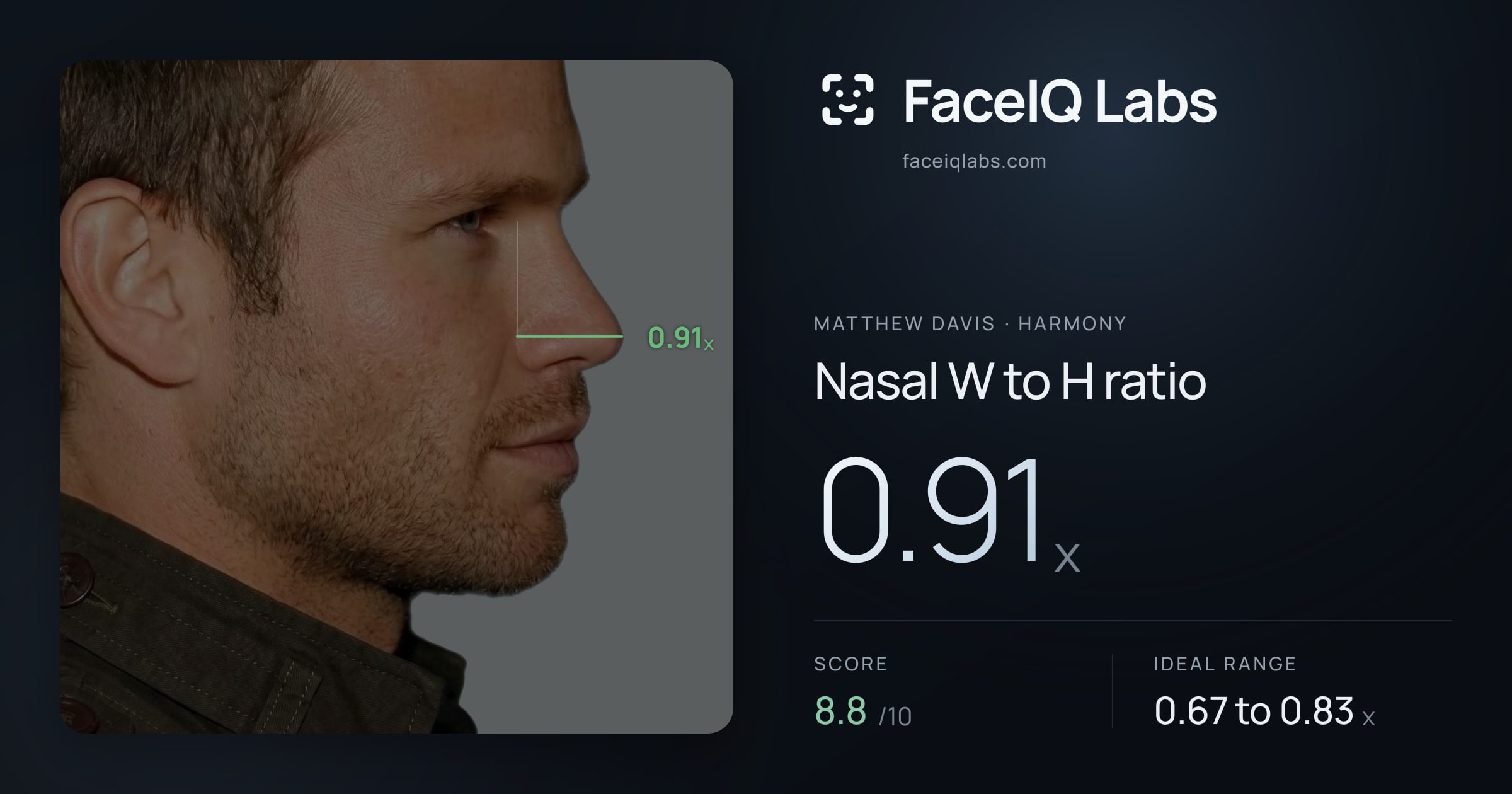 Matthew Davis Nasal W to H ratio: 0.91x, drawn on the photo