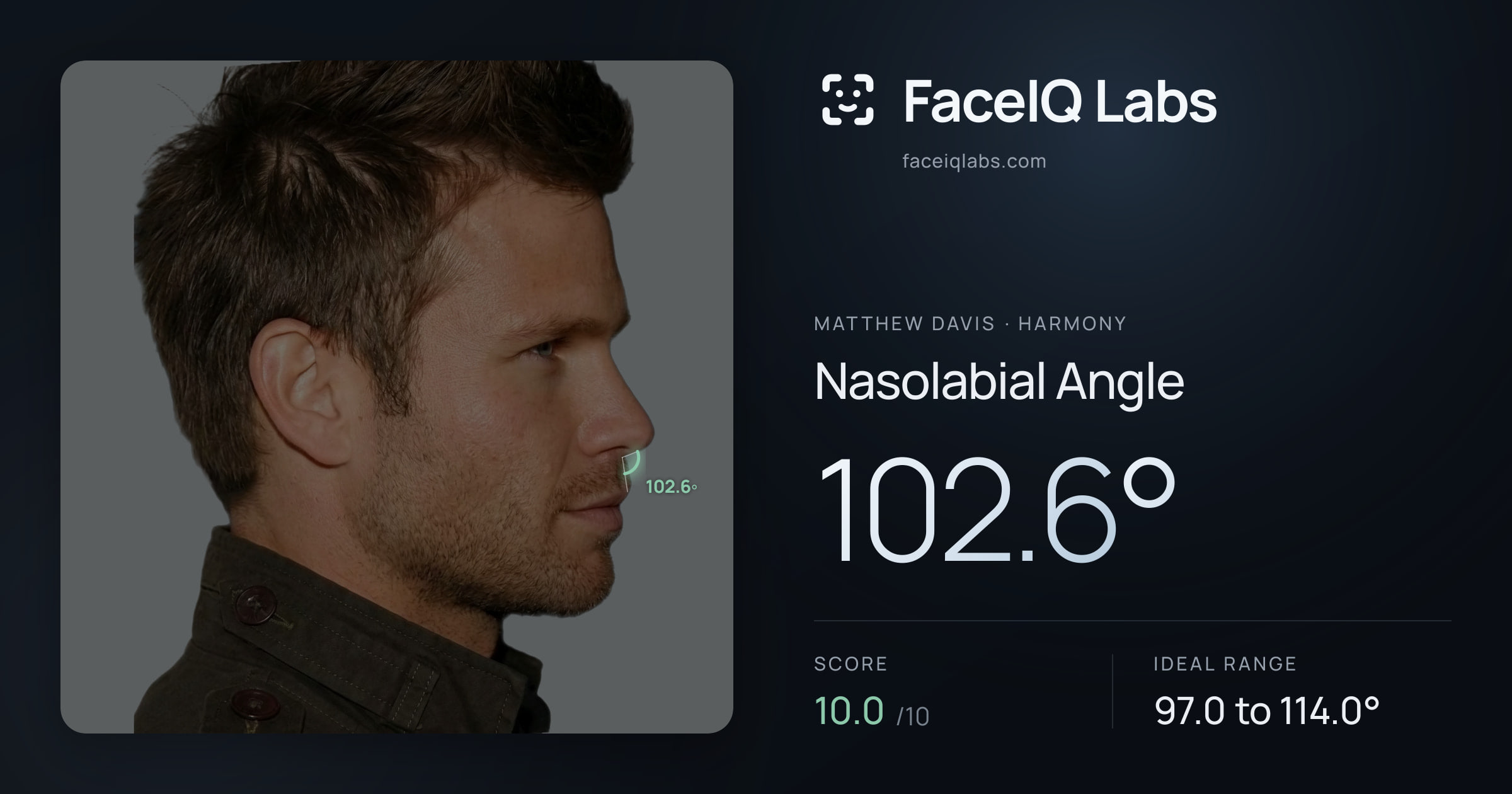 Matthew Davis Nasolabial Angle: 102.6°, drawn on the photo