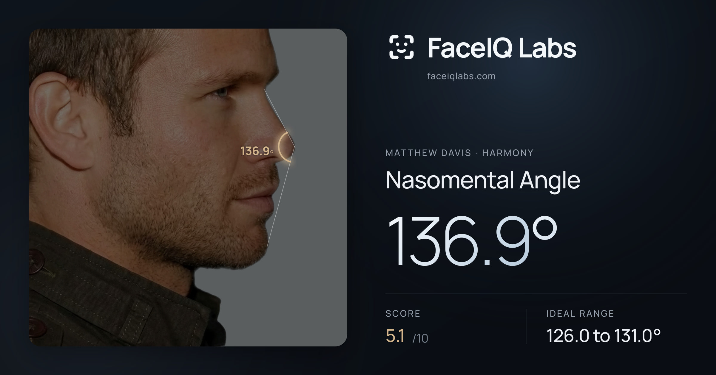 Matthew Davis Nasomental Angle: 136.9°, drawn on the photo
