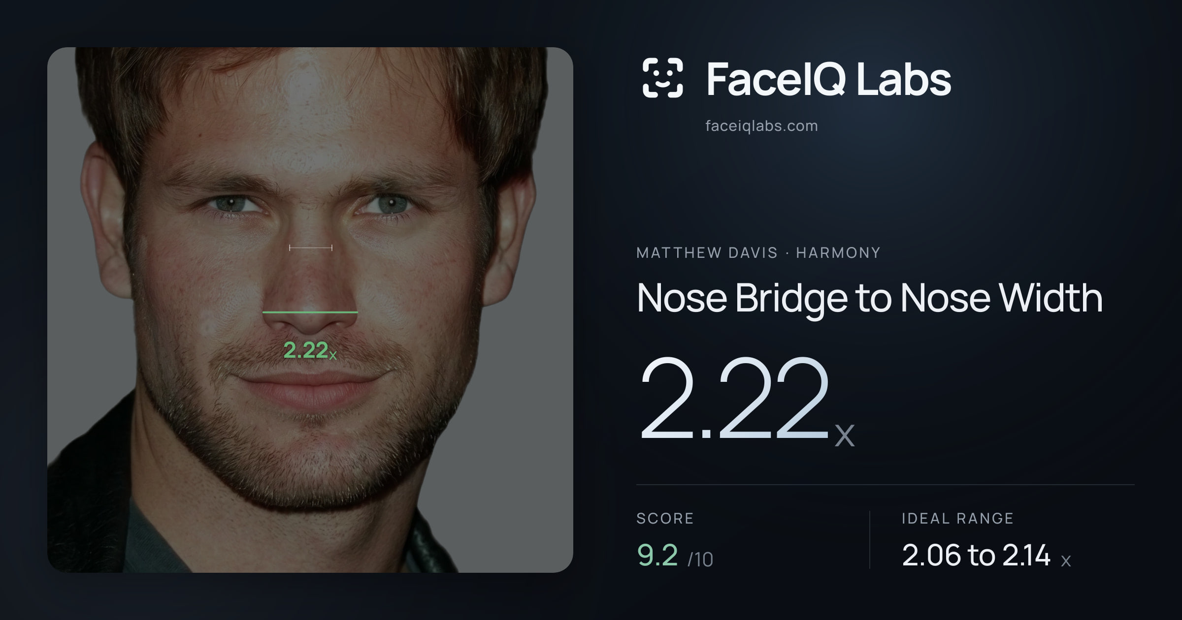 Matthew Davis Nose Bridge to Nose Width: 2.22x, drawn on the photo