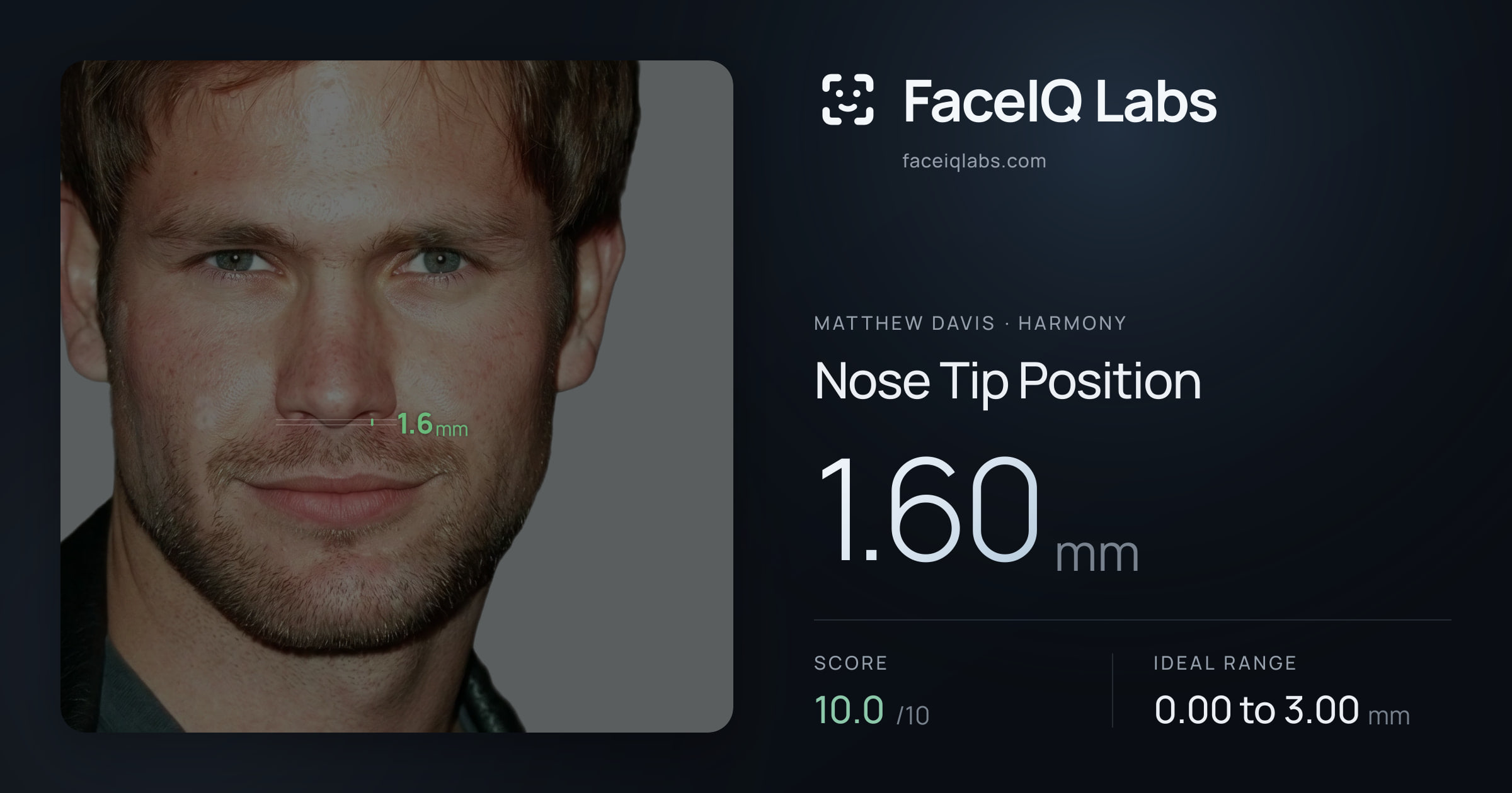 Matthew Davis Nose Tip Position: 1.60mm, drawn on the photo
