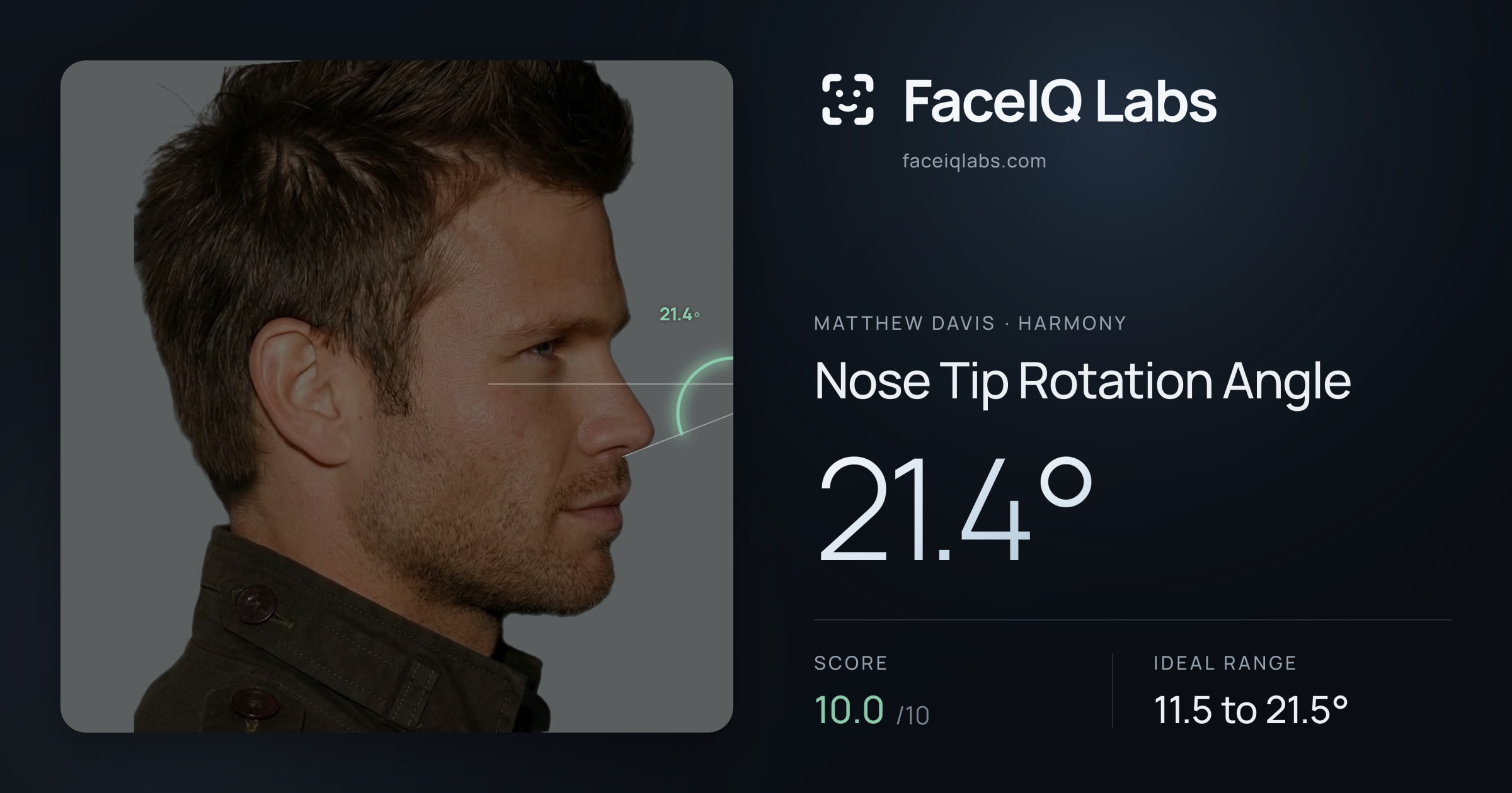 Matthew Davis Nose Tip Rotation Angle: 21.4°, drawn on the photo