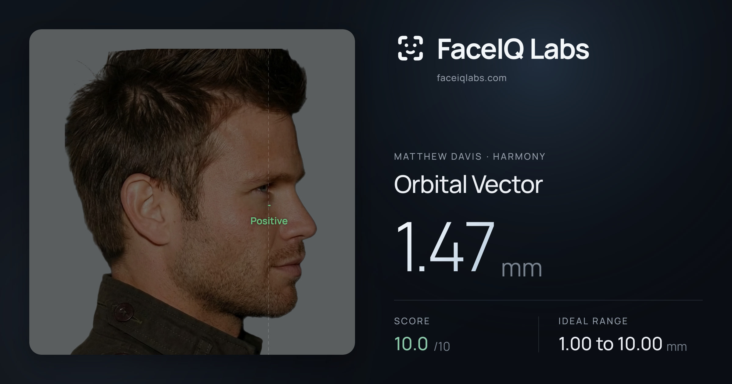 Matthew Davis Orbital Vector: 1.47mm, drawn on the photo
