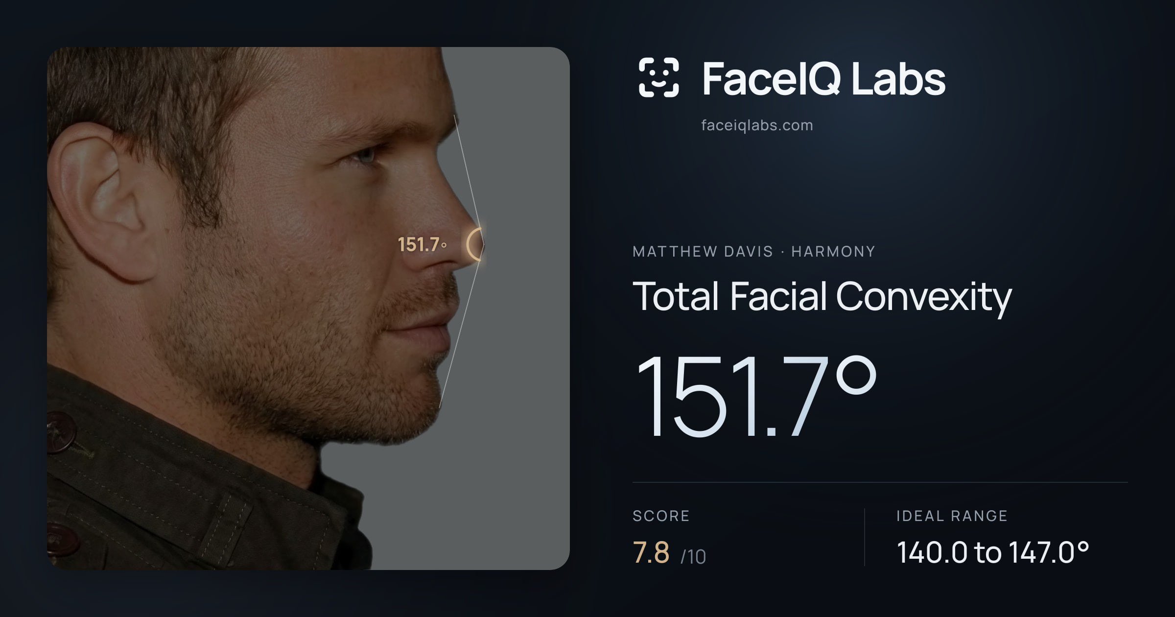 Matthew Davis Total Facial Convexity: 151.7°, drawn on the photo