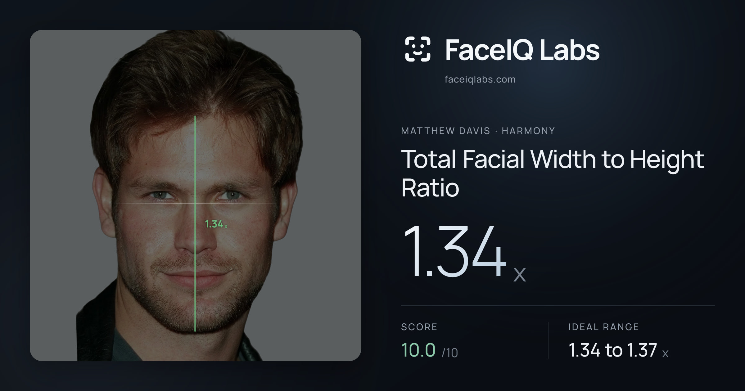 Matthew Davis Total Facial Width to Height Ratio: 1.34x, drawn on the photo
