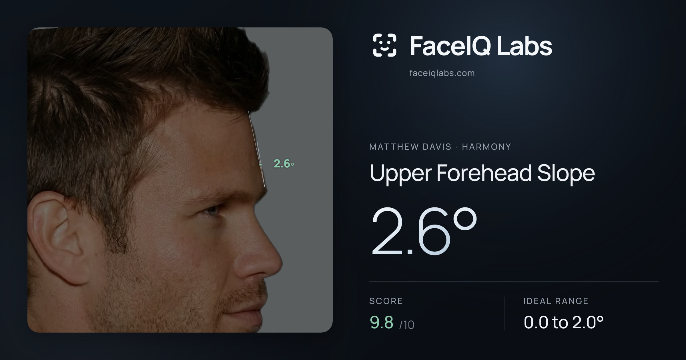 Matthew Davis Upper Forehead Slope: 2.6°, drawn on the photo