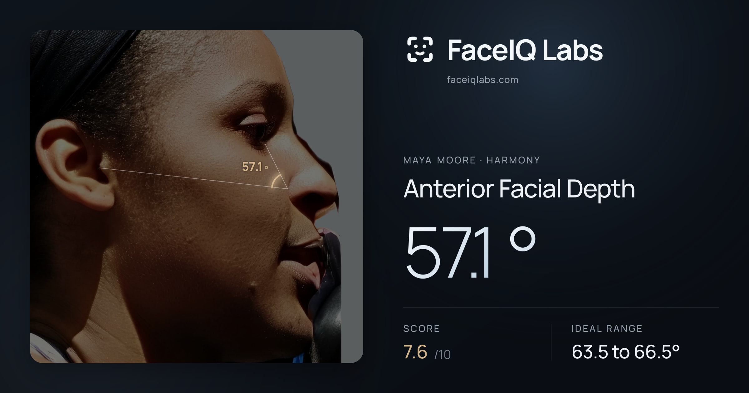Maya Moore Anterior Facial Depth: 57.1°, drawn on the photo