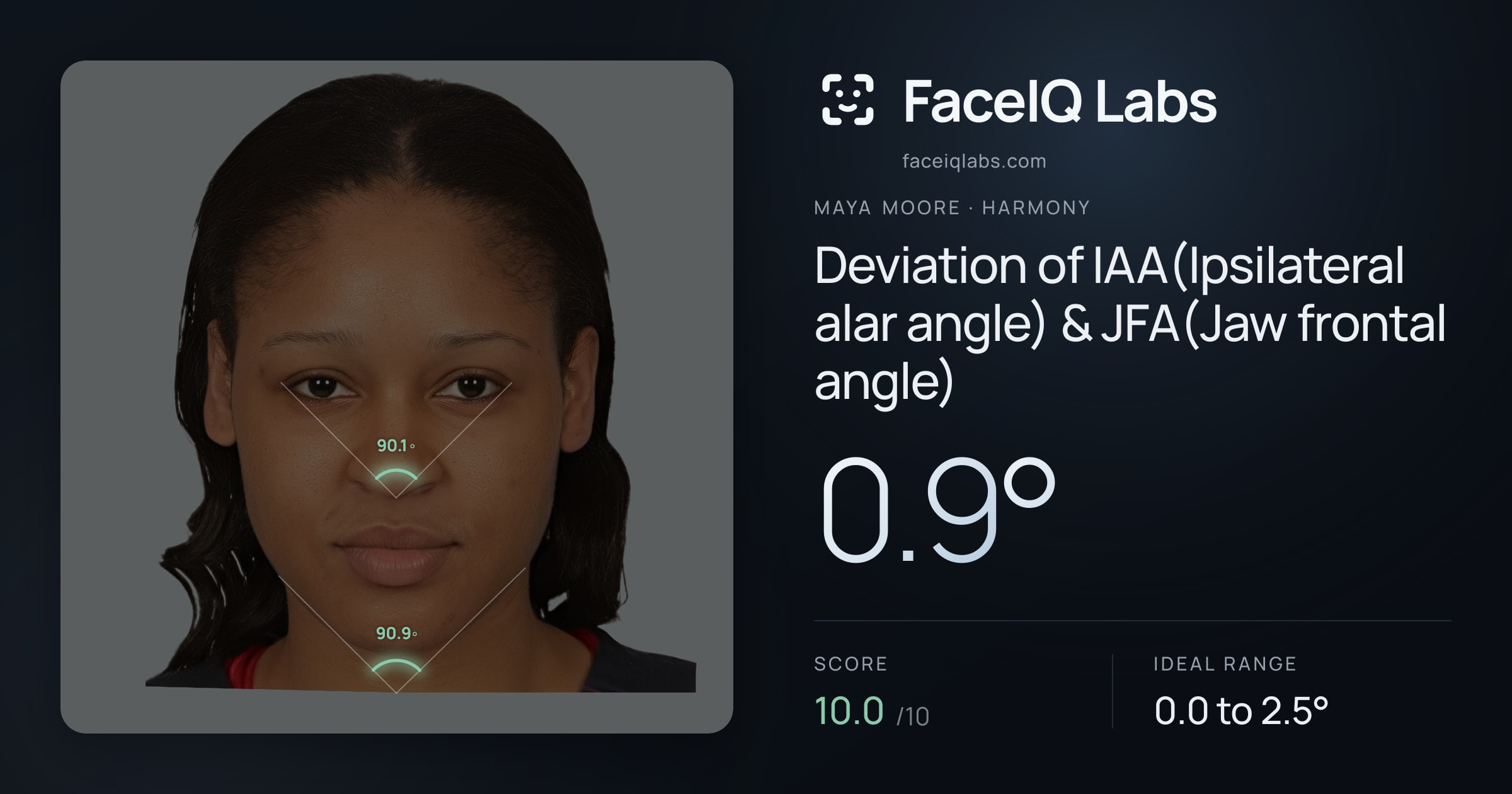 Maya Moore Deviation of IAA(Ipsilateral alar angle) & JFA(Jaw frontal angle): 0.9°, drawn on the photo