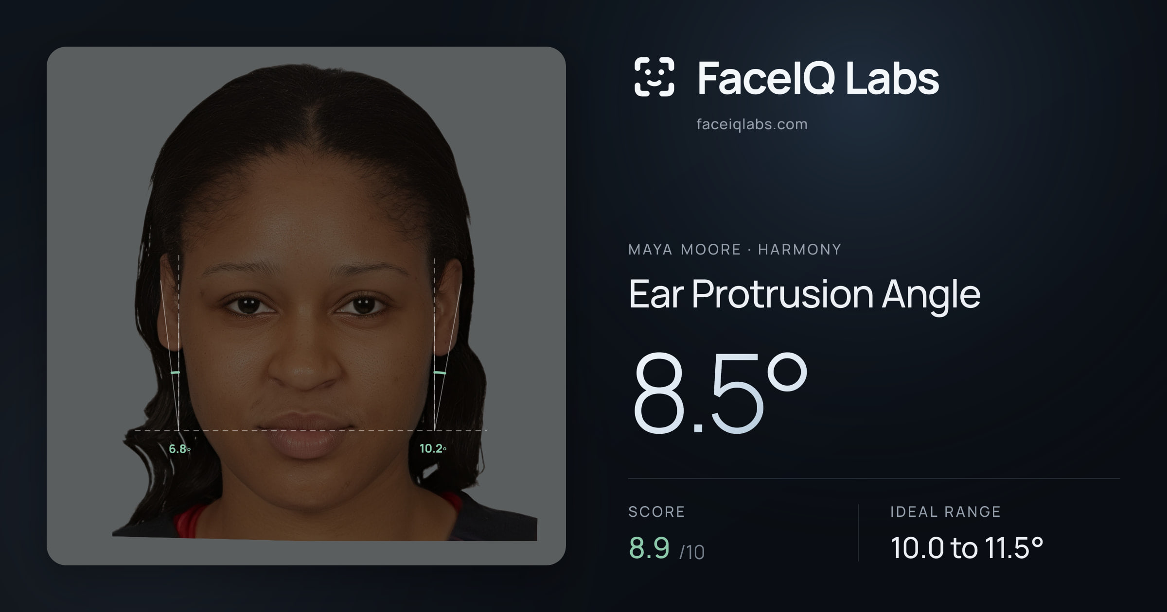 Maya Moore Ear Protrusion Angle: 8.5°, drawn on the photo