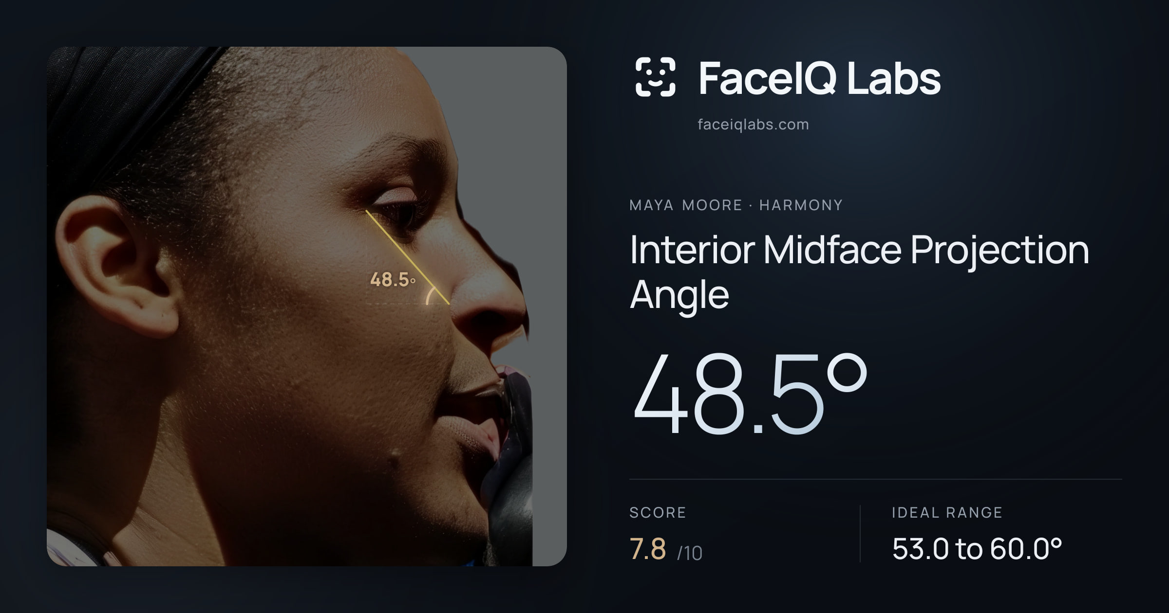 Maya Moore Interior Midface Projection Angle: 48.5°, drawn on the photo