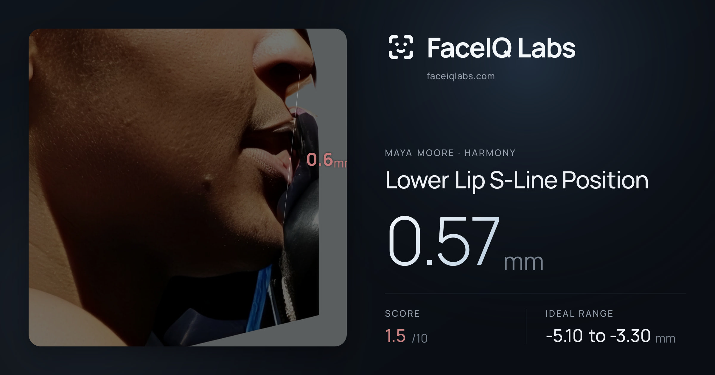 Maya Moore Lower Lip S-Line Position: 0.57mm, drawn on the photo